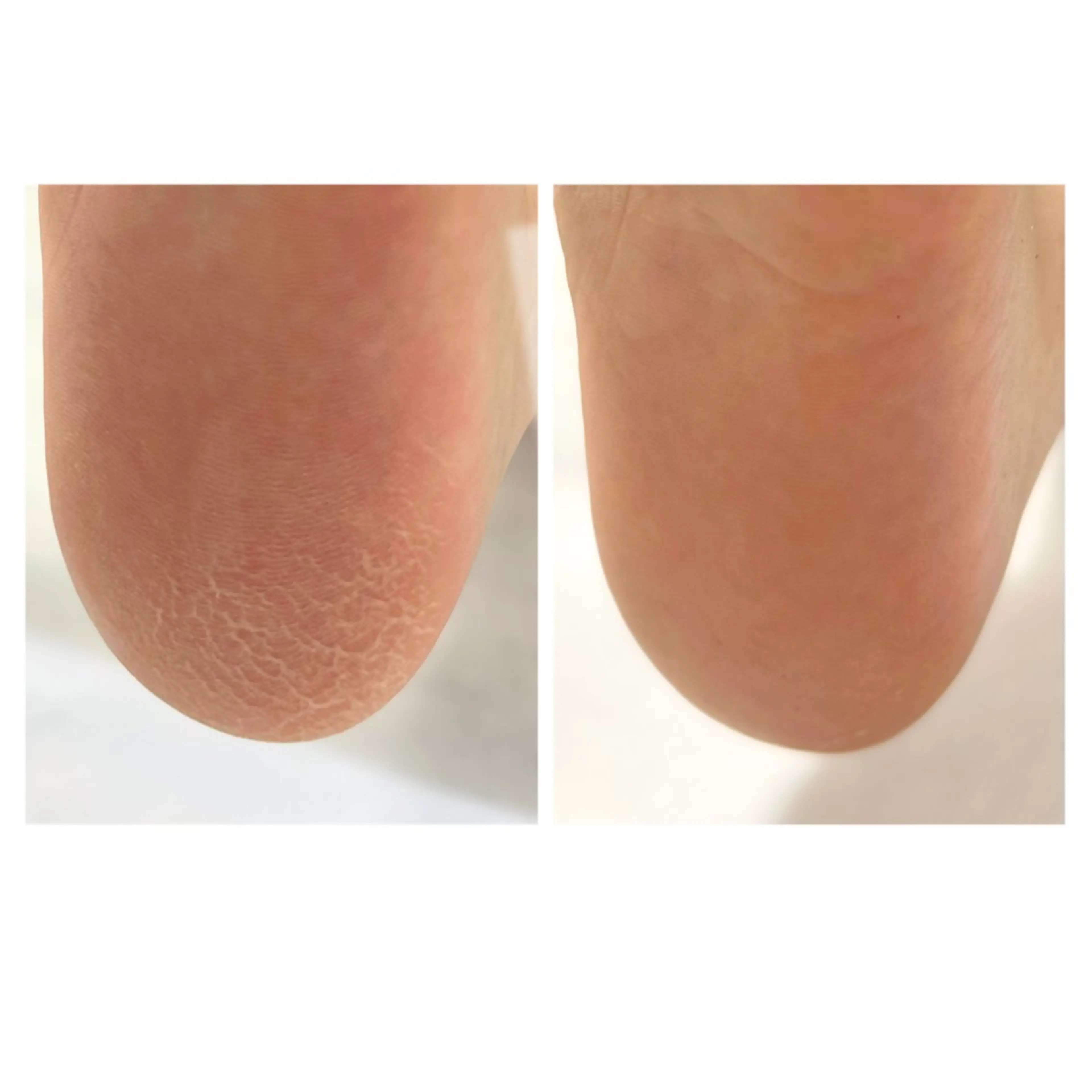 その他 なが さきのネイルデザイン