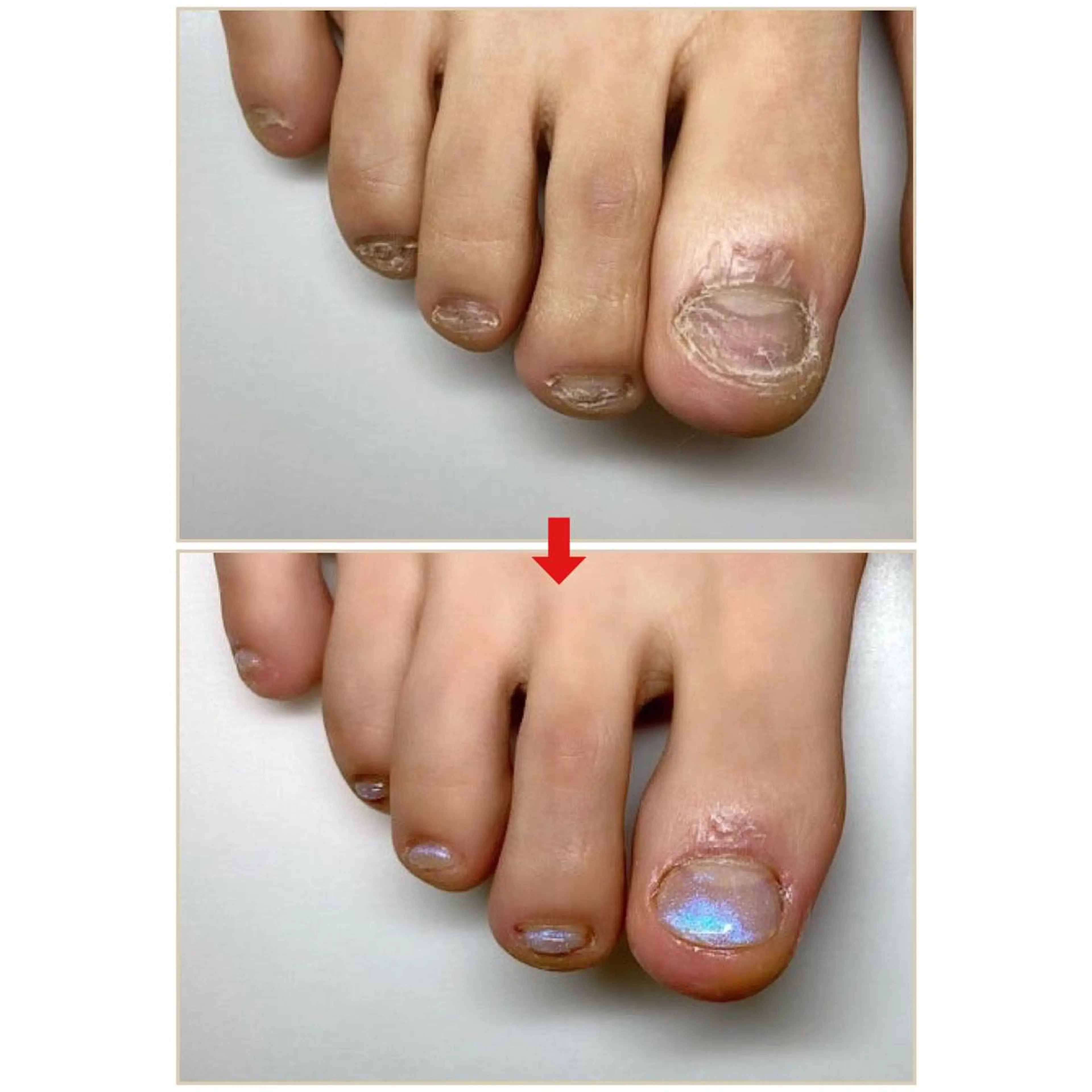 ネイル ネイルサロン アリュームのネイルデザイン