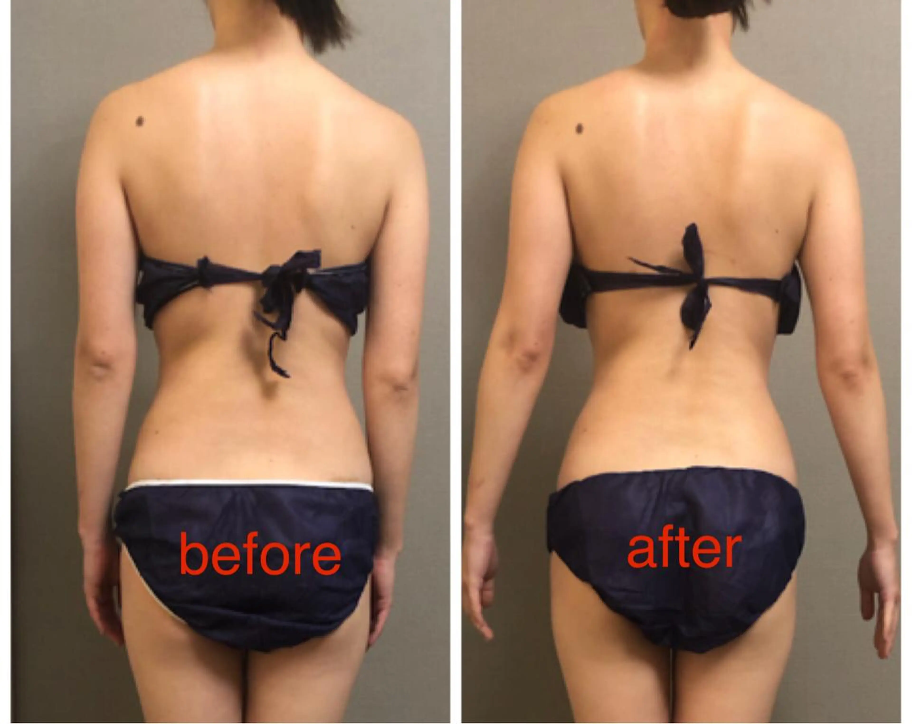 エステ リラク 美ola ビオラのエステ・リラクイメージ