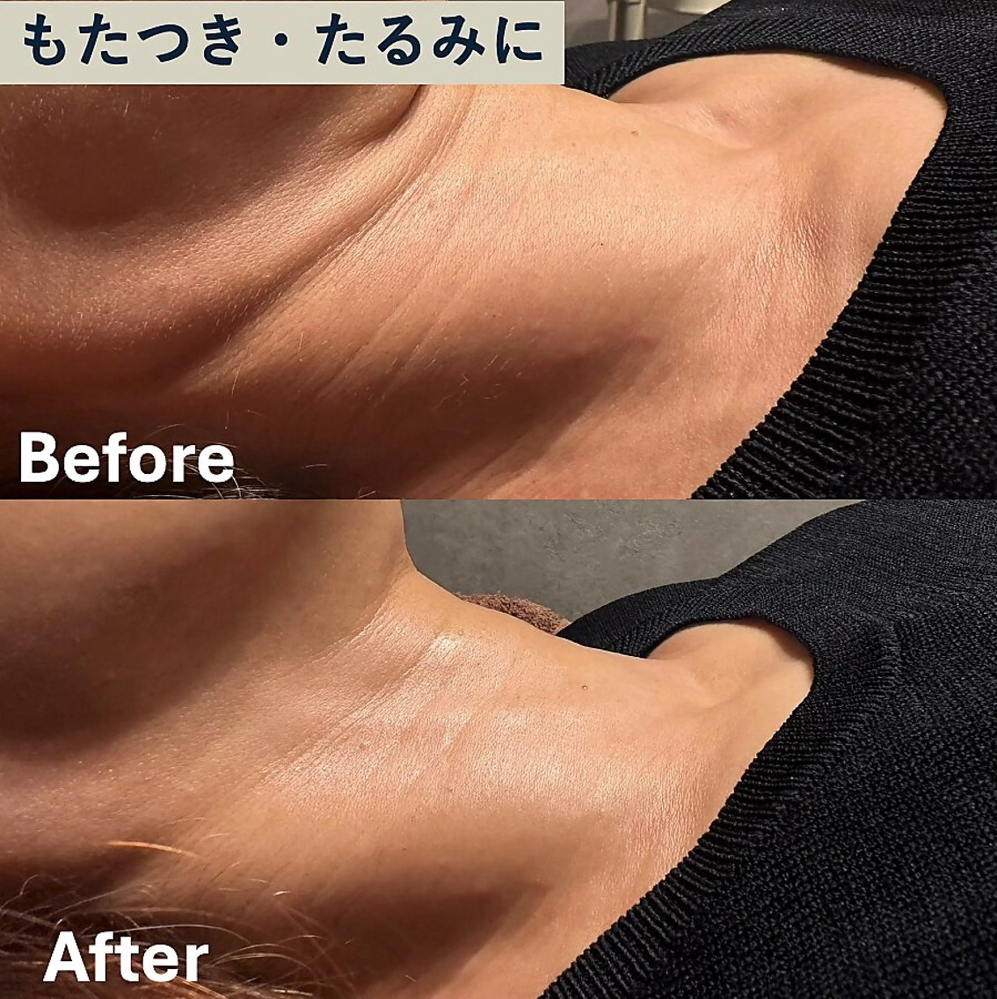 【もたつき】高速タッピング＋美容液導入で若々しい小顔へ🫧の写真