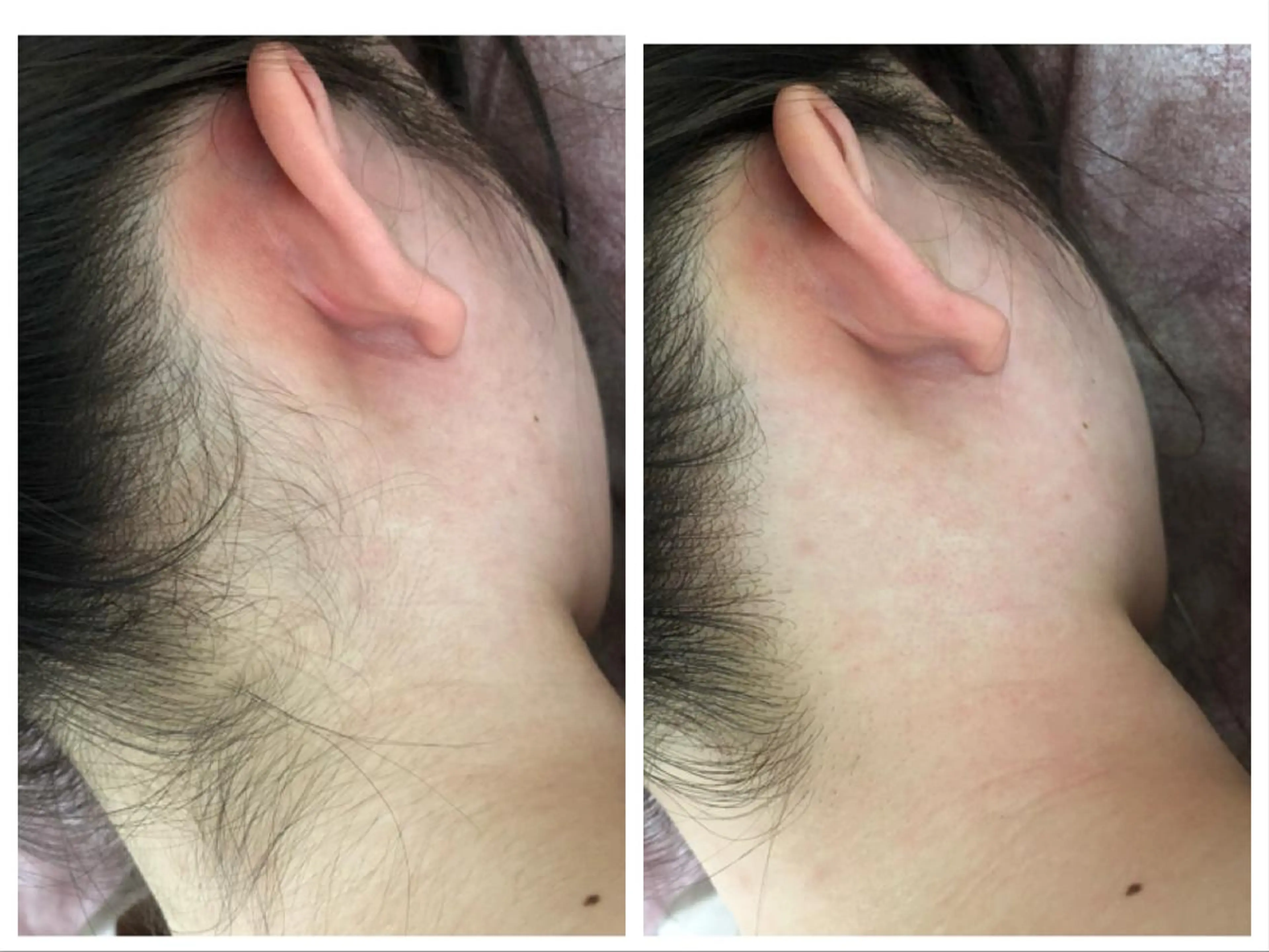 脱毛 Prima 痩身脱毛 にごうかおりのエステ・リラクイメージ