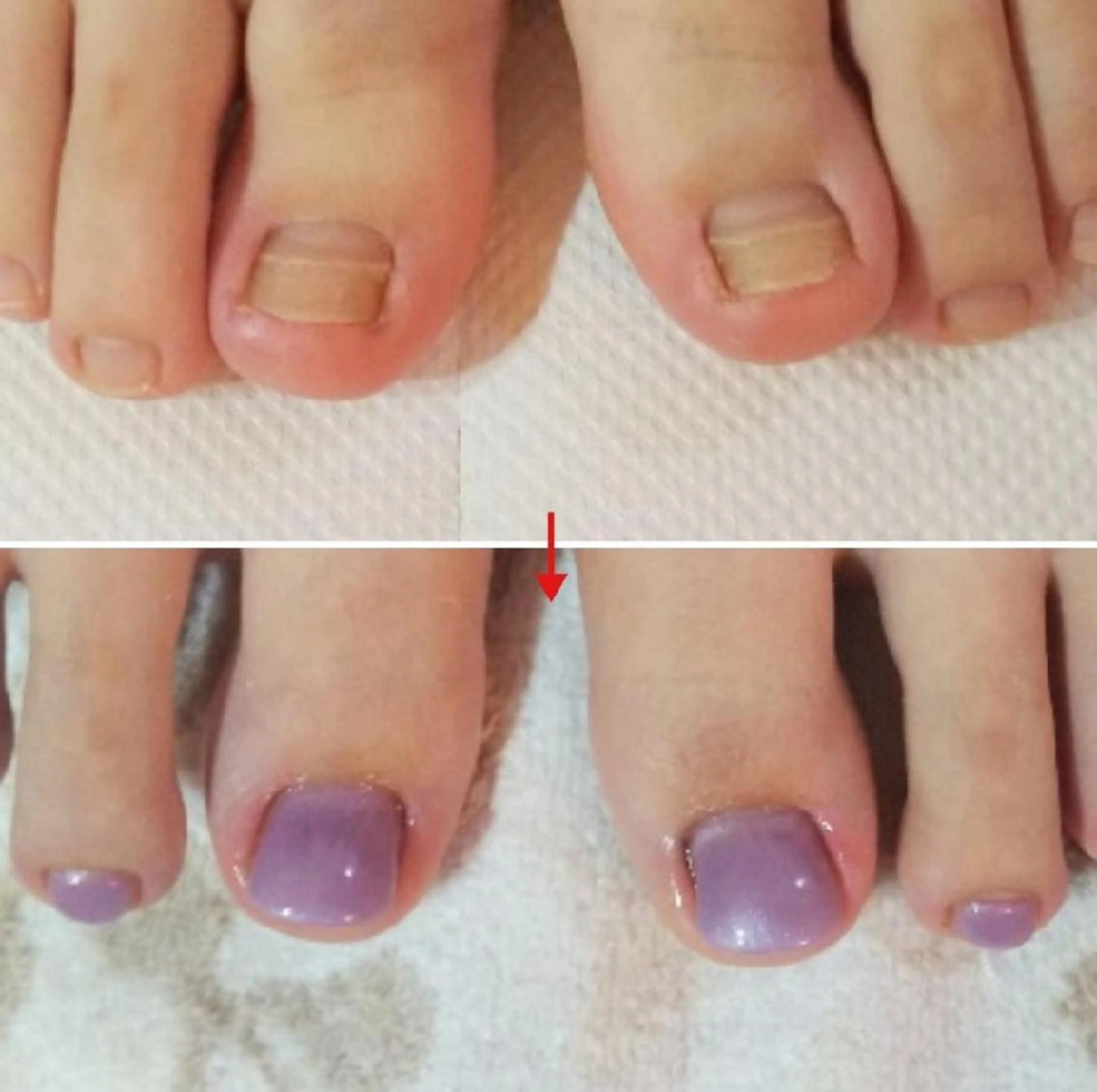 ネイル フットネイル ネイルサロン アリュームのネイルデザイン