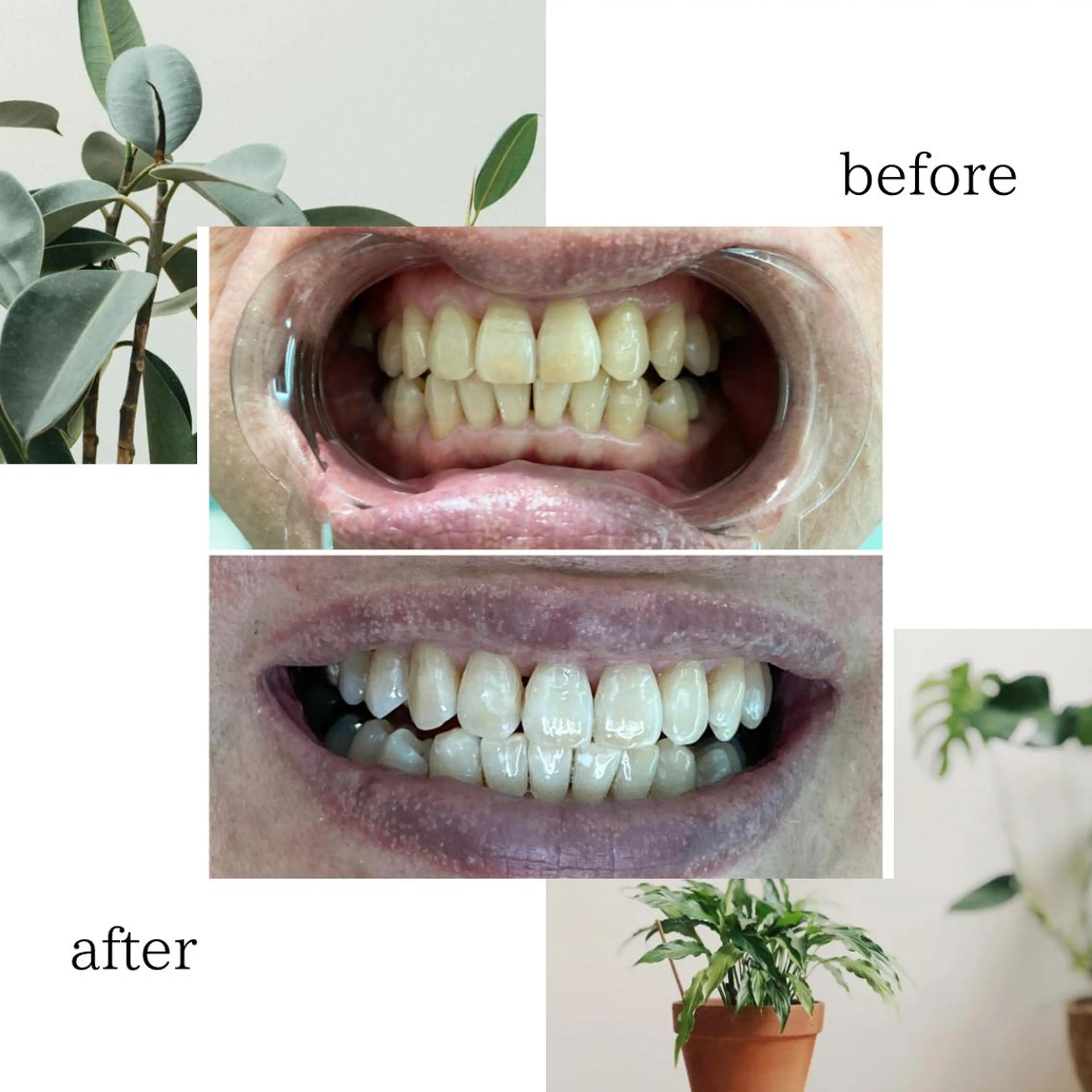 その他 脱毛専門サロンELIXIR（ｴﾘｸｻｰ）所属・脱毛&ホワイトニング ELIXIR×ULTのエステ・リラクイメージ