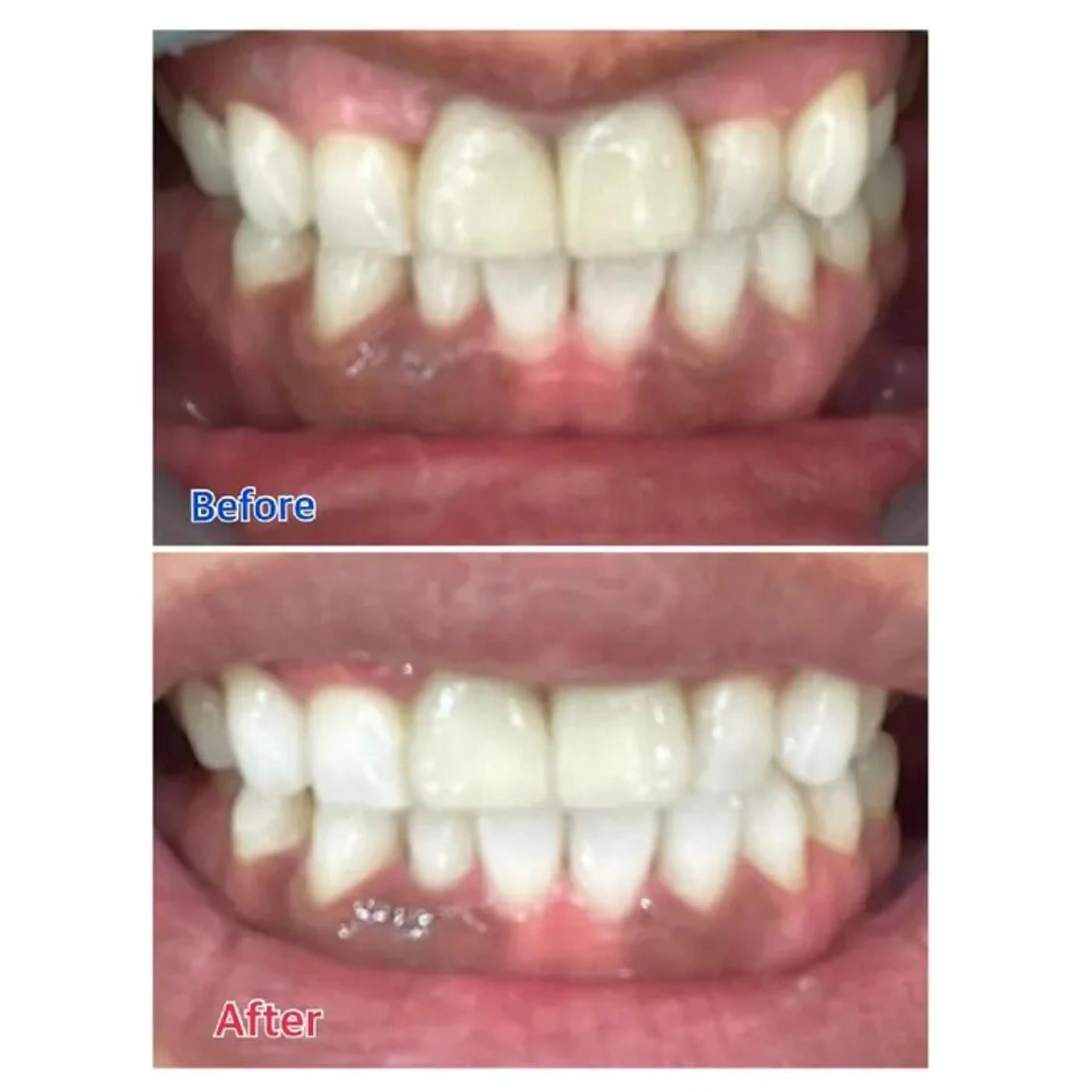 M渋谷 ホワイトニングのエステ・リラクイメージ