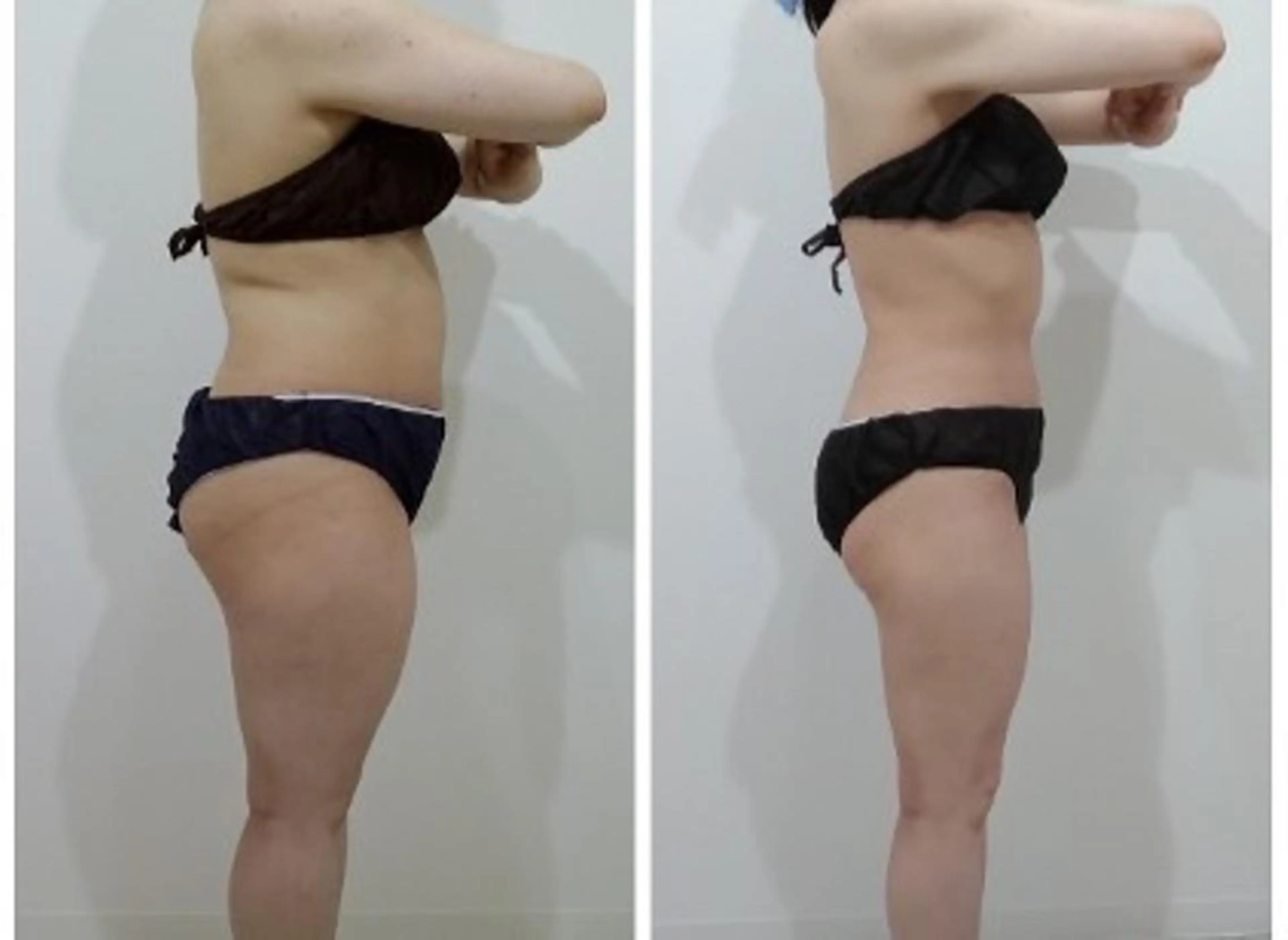 エステ 秒速小顔  新宿店所属・秒速小顔 新宿店 さきのエステ・リラクイメージ