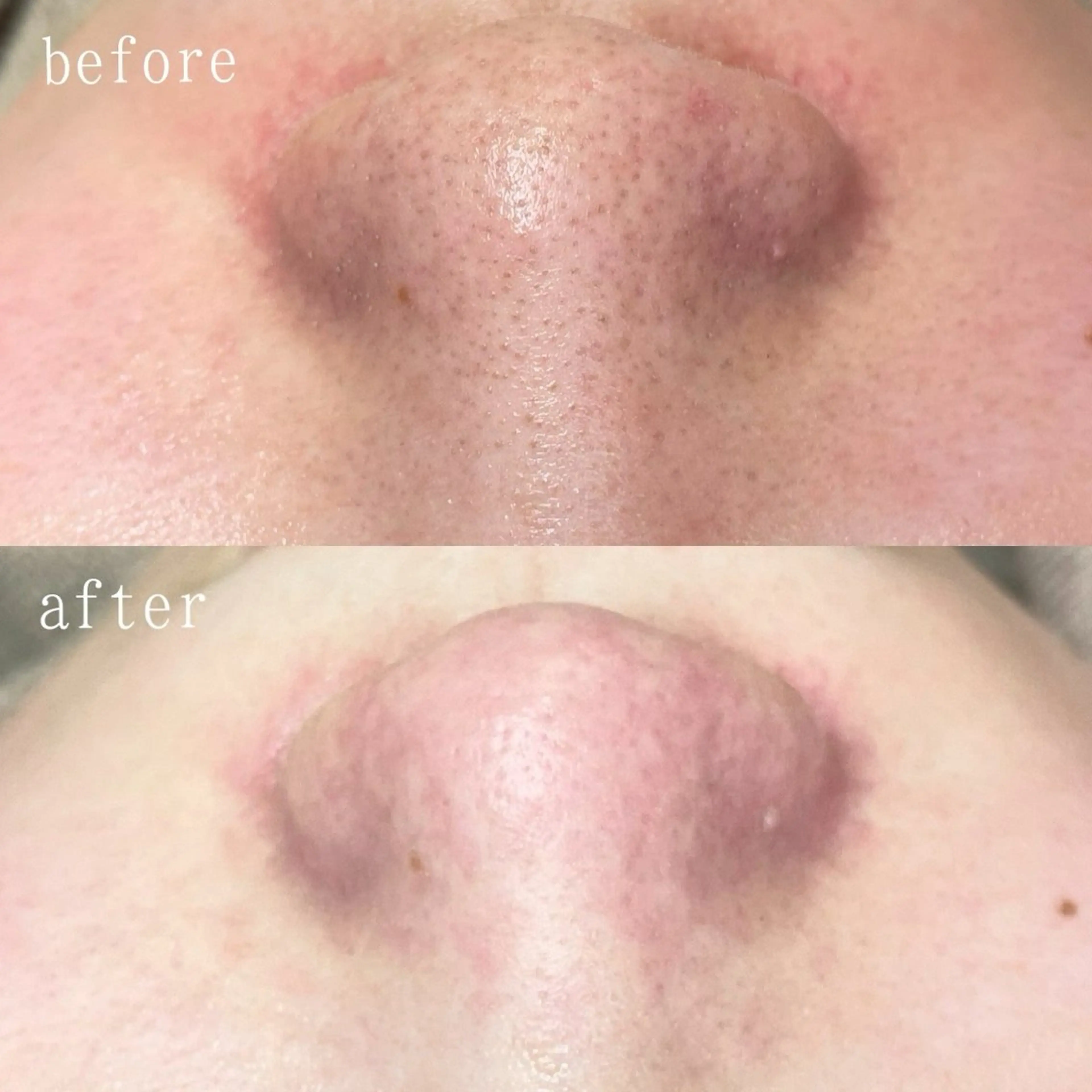 エステ 宮川 真帆のエステ・リラクイメージ