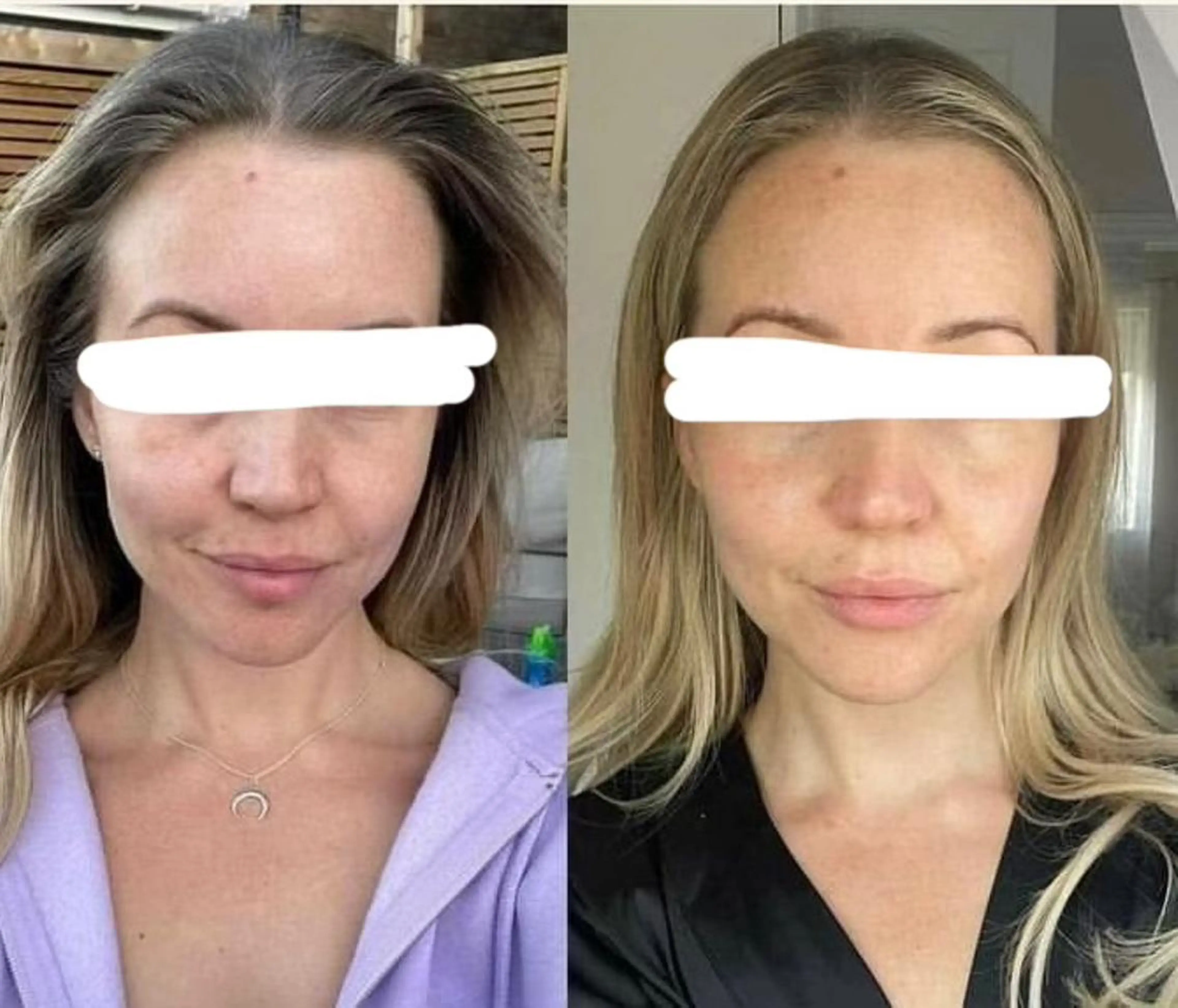 【美容整形級エステ】 服部隆美のエステ・リラクイメージ