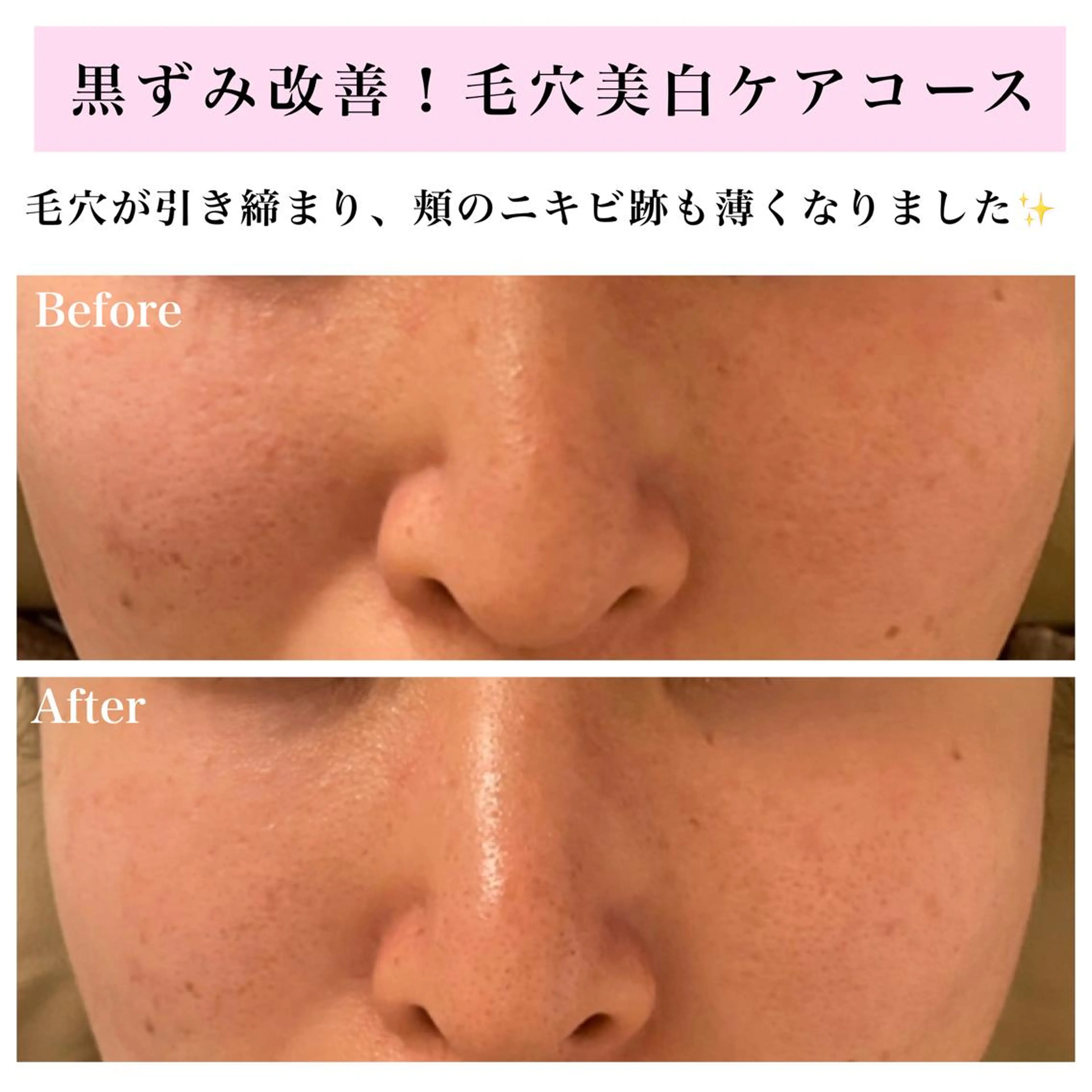 エステ リラク Bellesthe （ベルエステ）のエステ・リラクイメージ