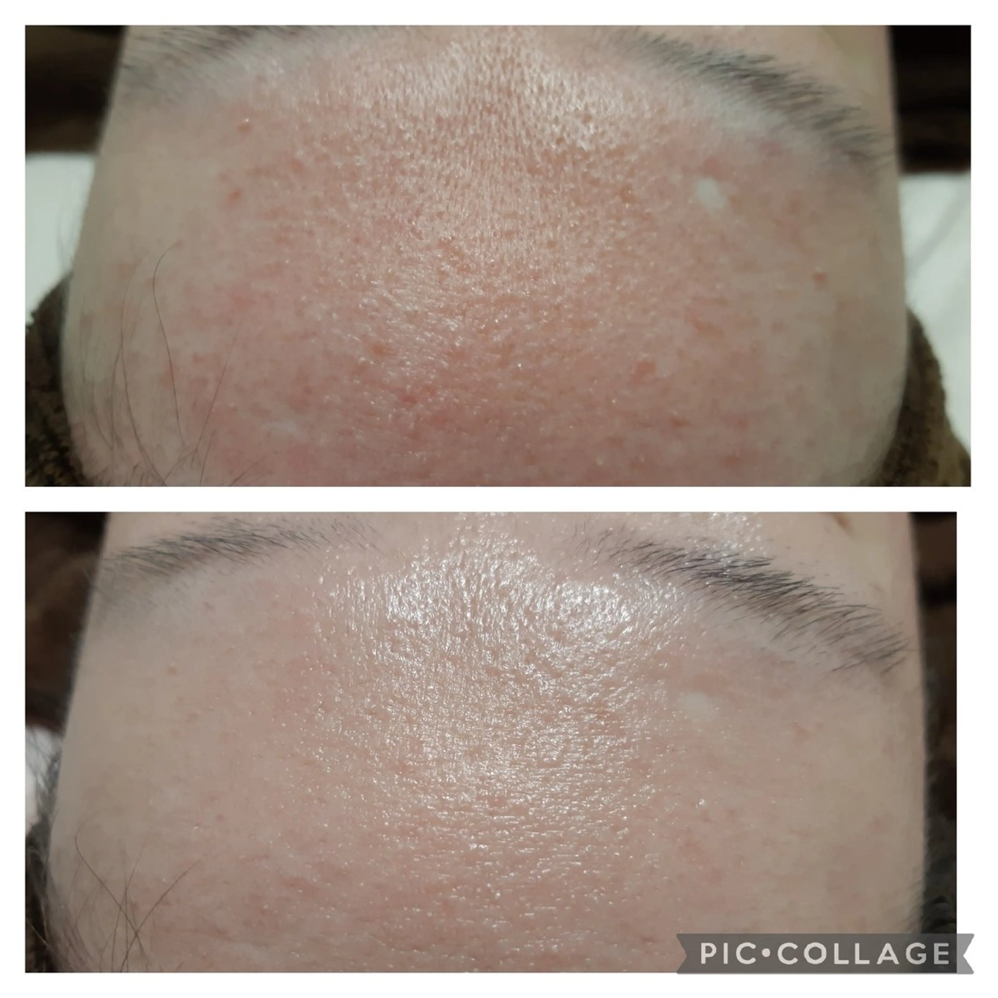 フェイシャルの写真