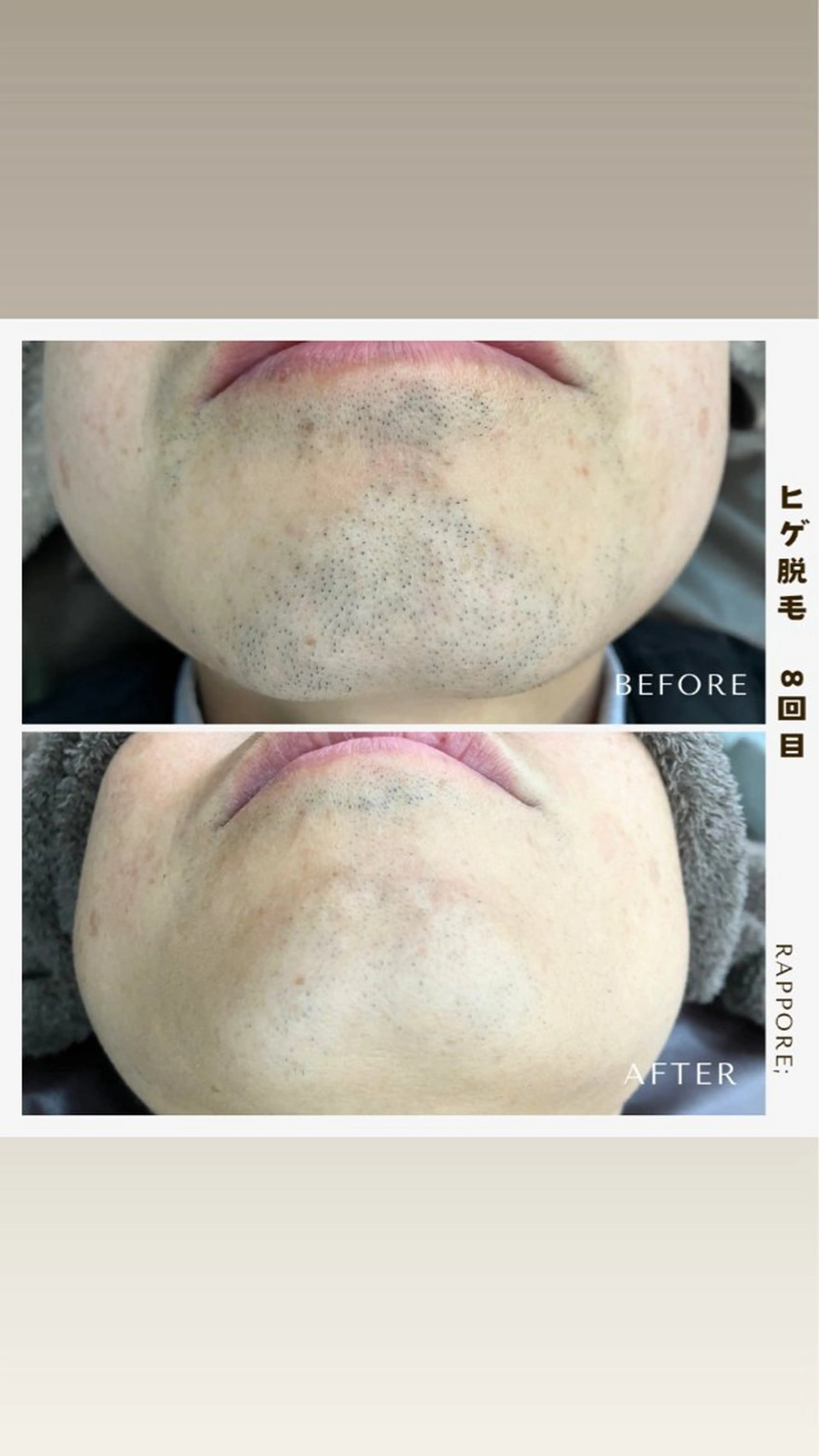 メンズ 古々本 明歩のエステ・リラクイメージ