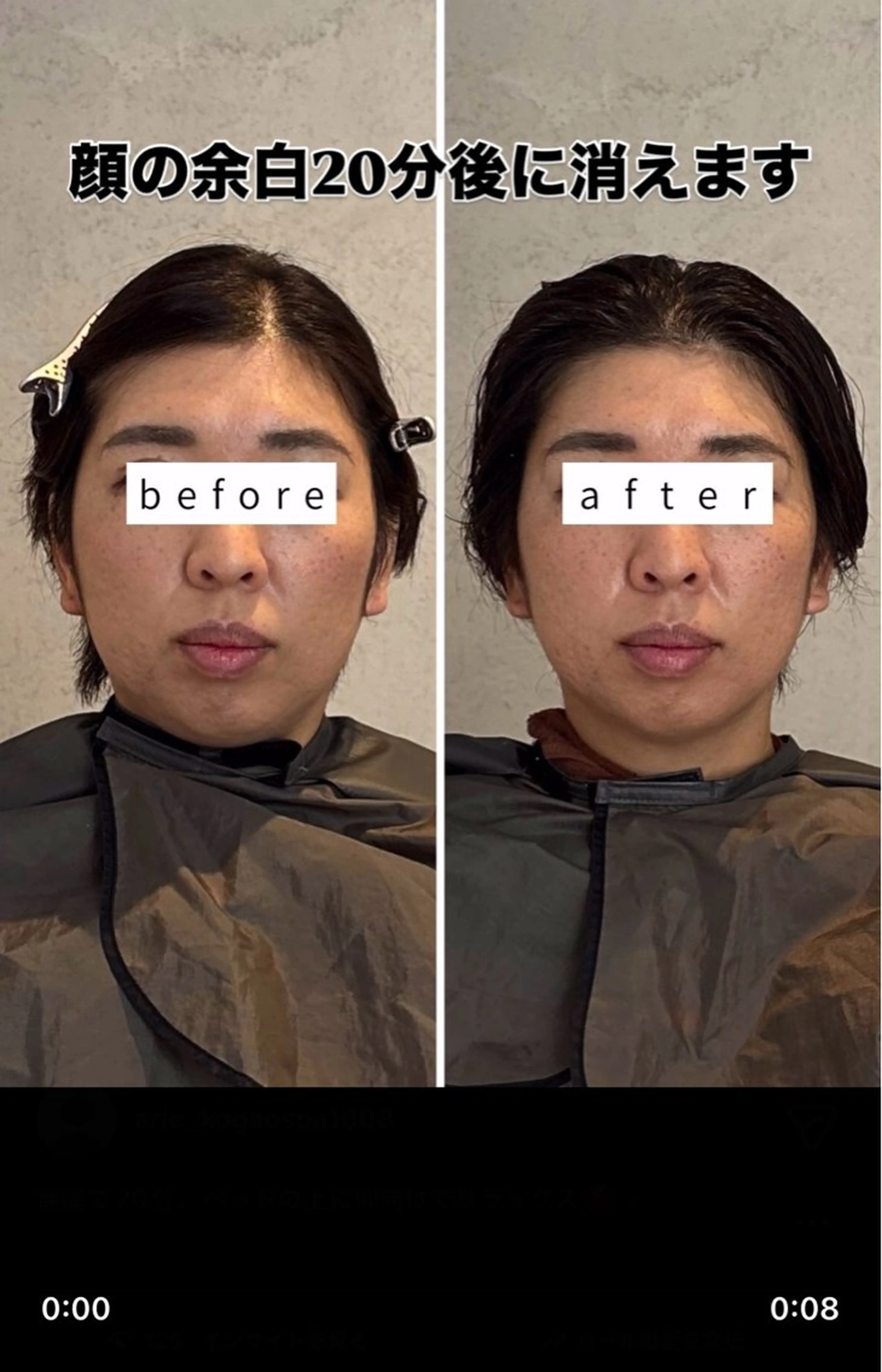 小顔矯正/ヘッドスパ /Arieのエステ・リラクイメージ