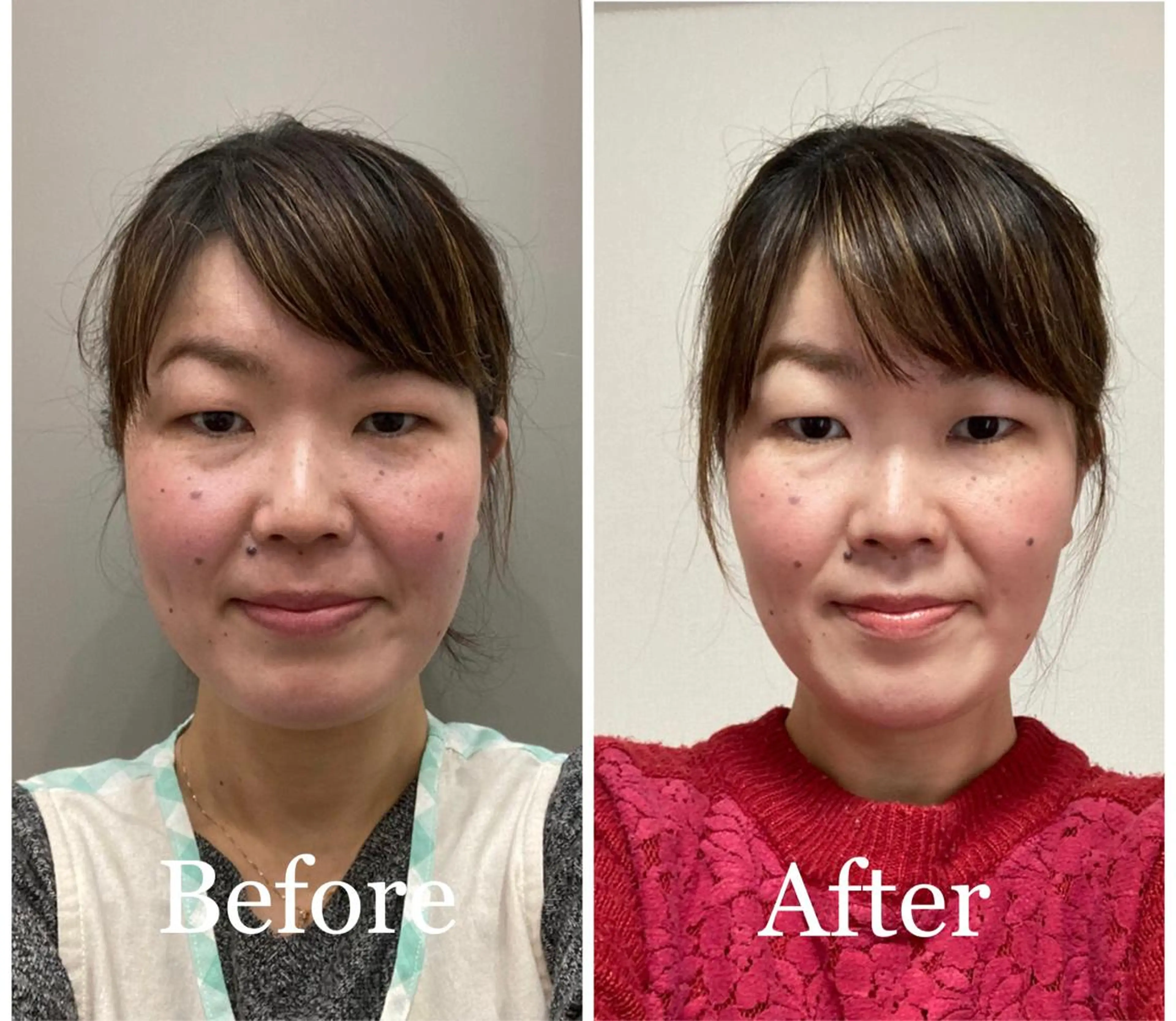 小顔矯正サロン AYURのエステ・リラクイメージ