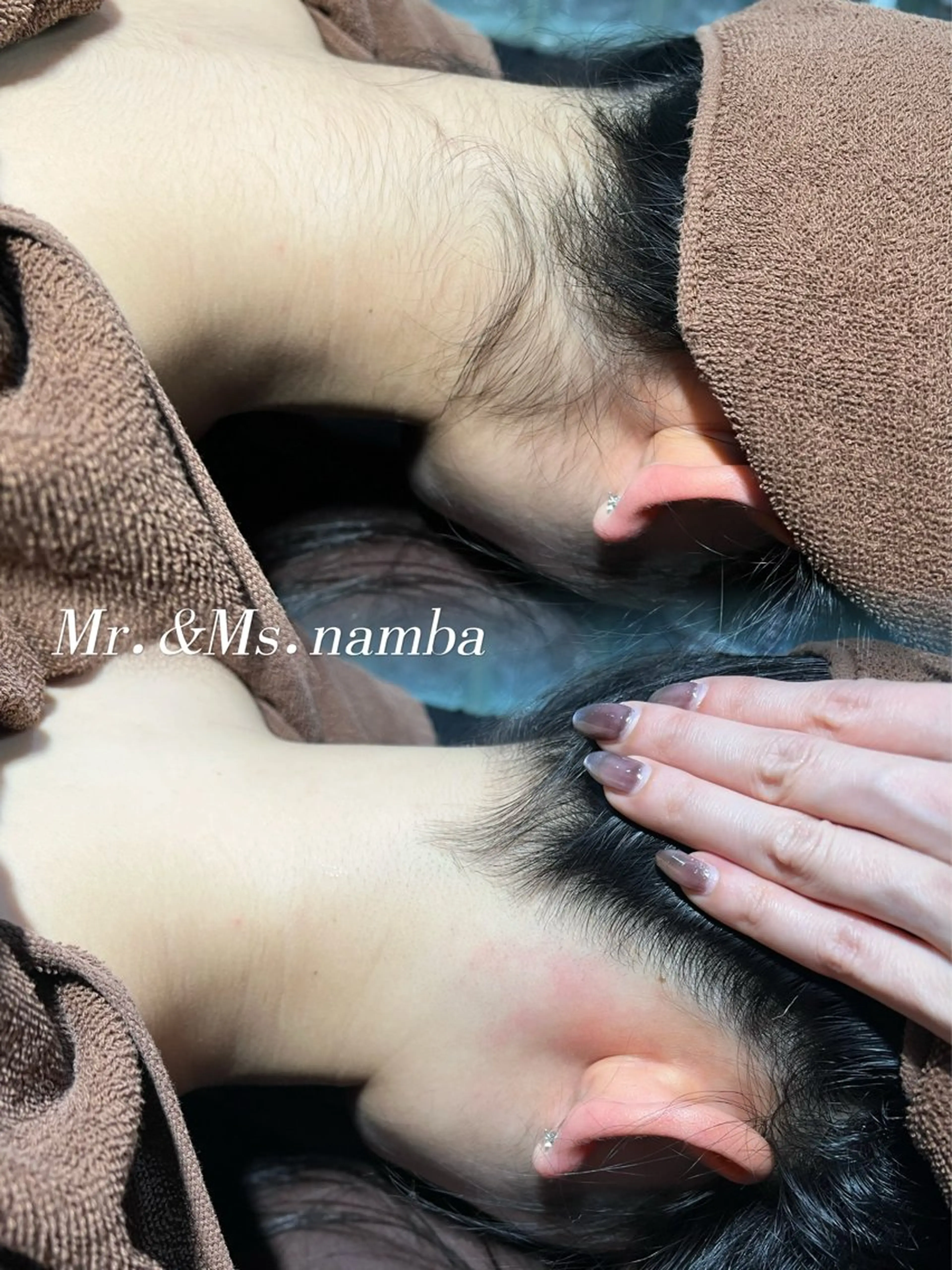 【綺麗スッキリ】うなじワックス脱毛 ¥4,000の写真