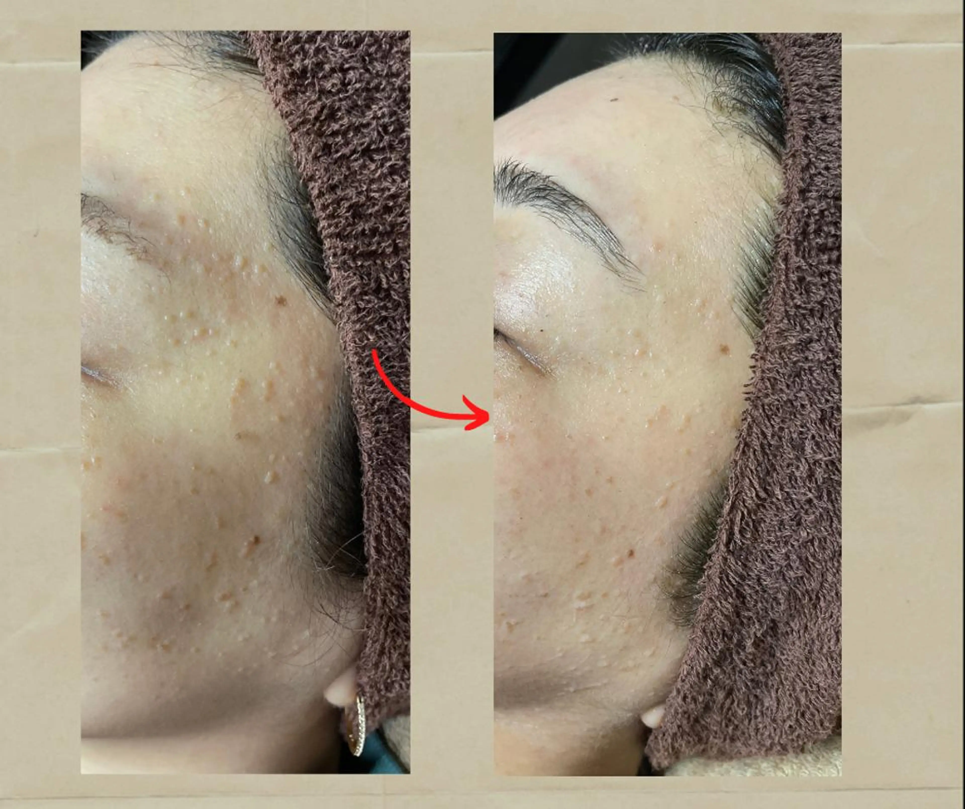 代表 MOMOのエステ・リラクイメージ