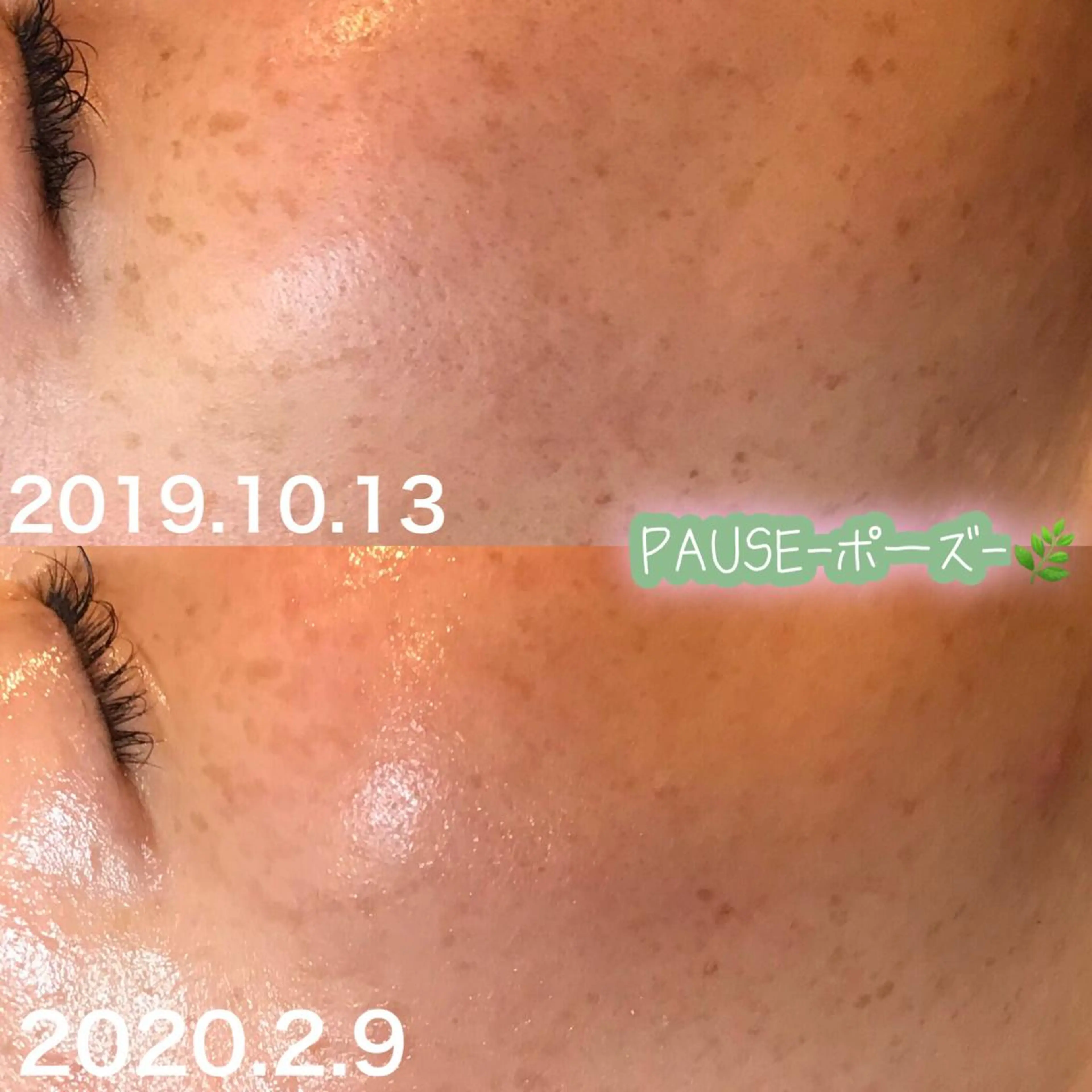 エステ 浜野 恵美のエステ・リラクイメージ