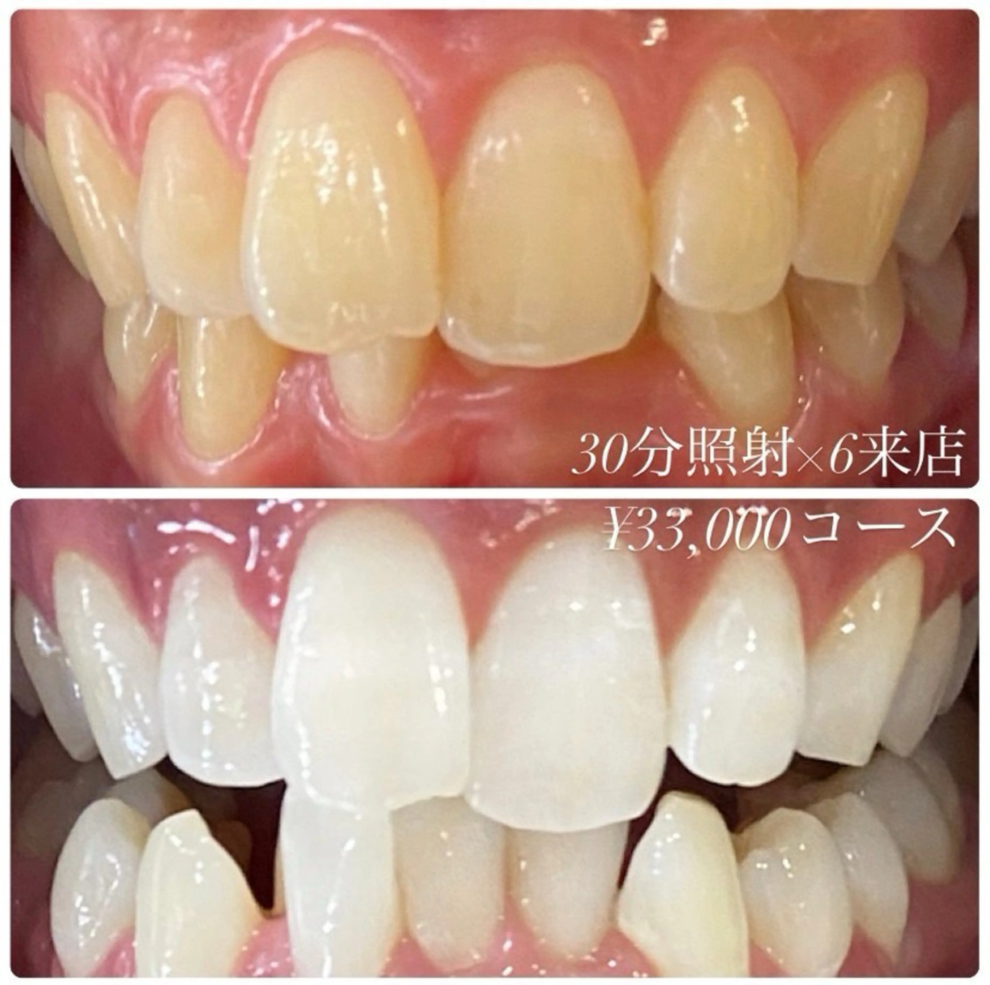 その他 PLATINUM Beauty 横浜店所属・ホワイトニングルーム 横浜店のその他イメージ