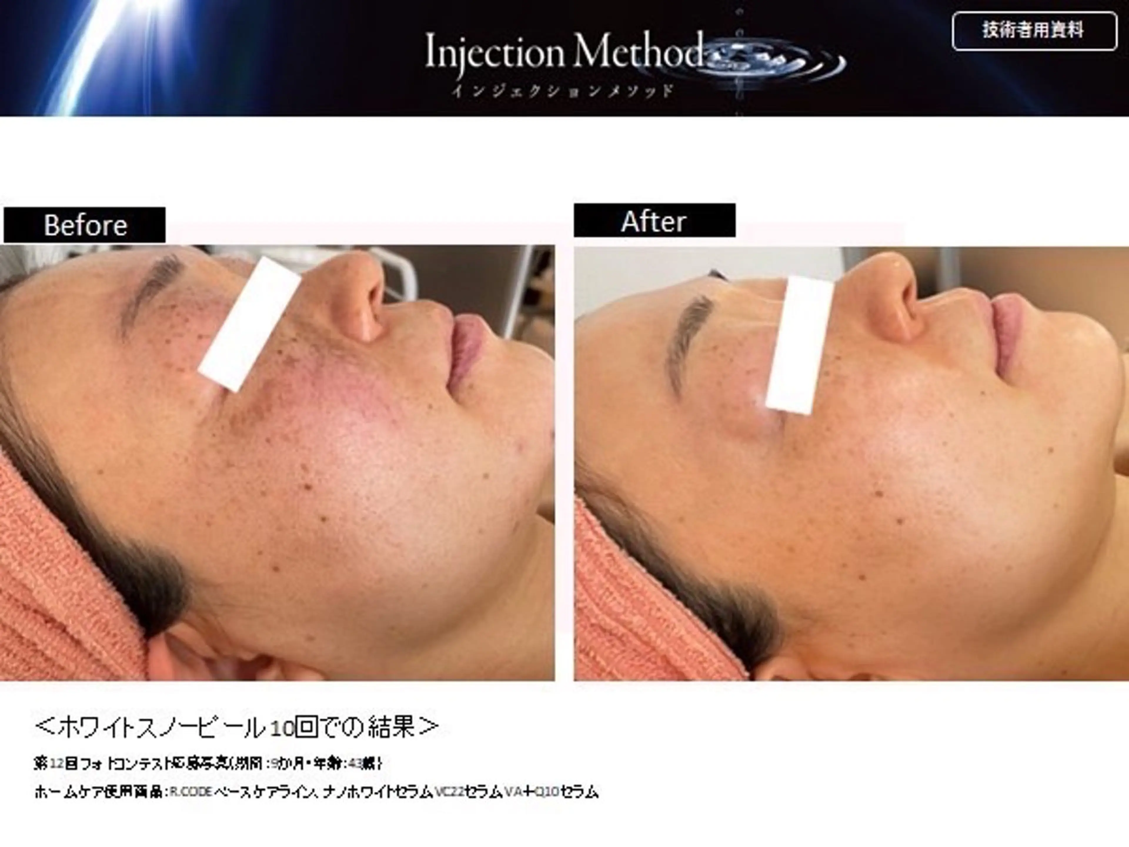 肌質改善サロン★ リュー・ド・ボウテのエステ・リラクイメージ