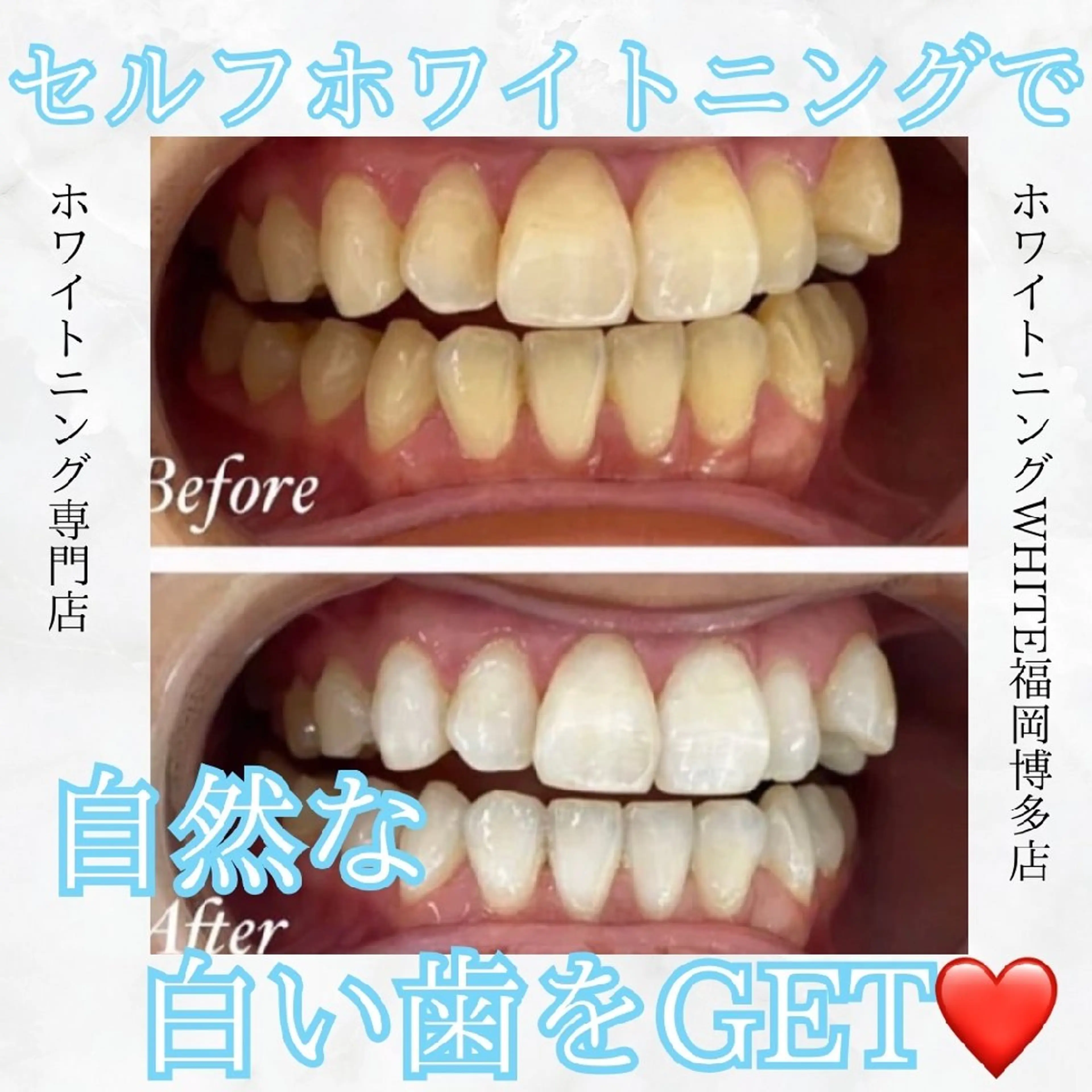 メンズ エステ リラク セルフホワイトニング WHITE福岡博多店のエステ・リラクイメージ