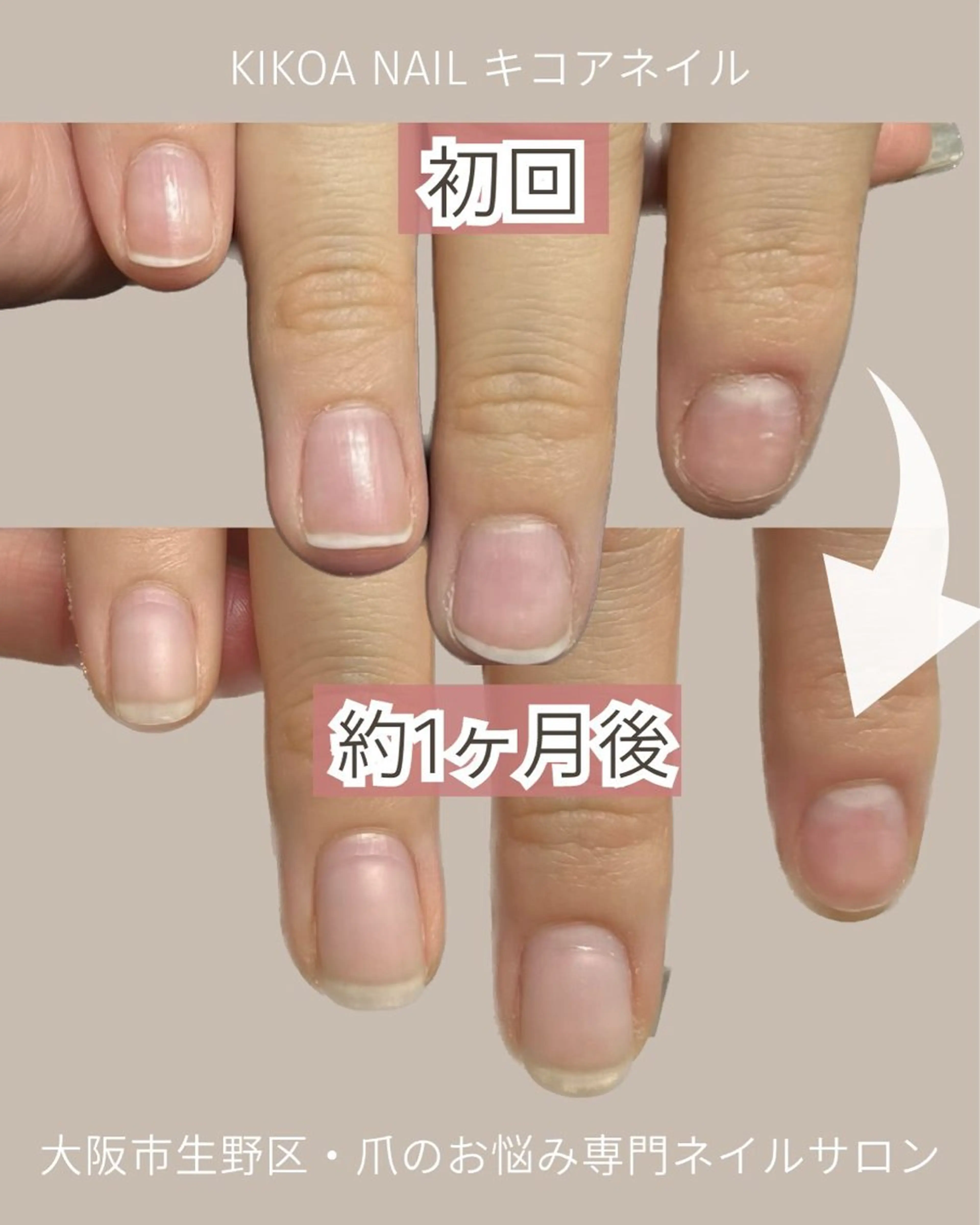 ネイル KIKOA NAIL キコアネイルのネイルデザイン