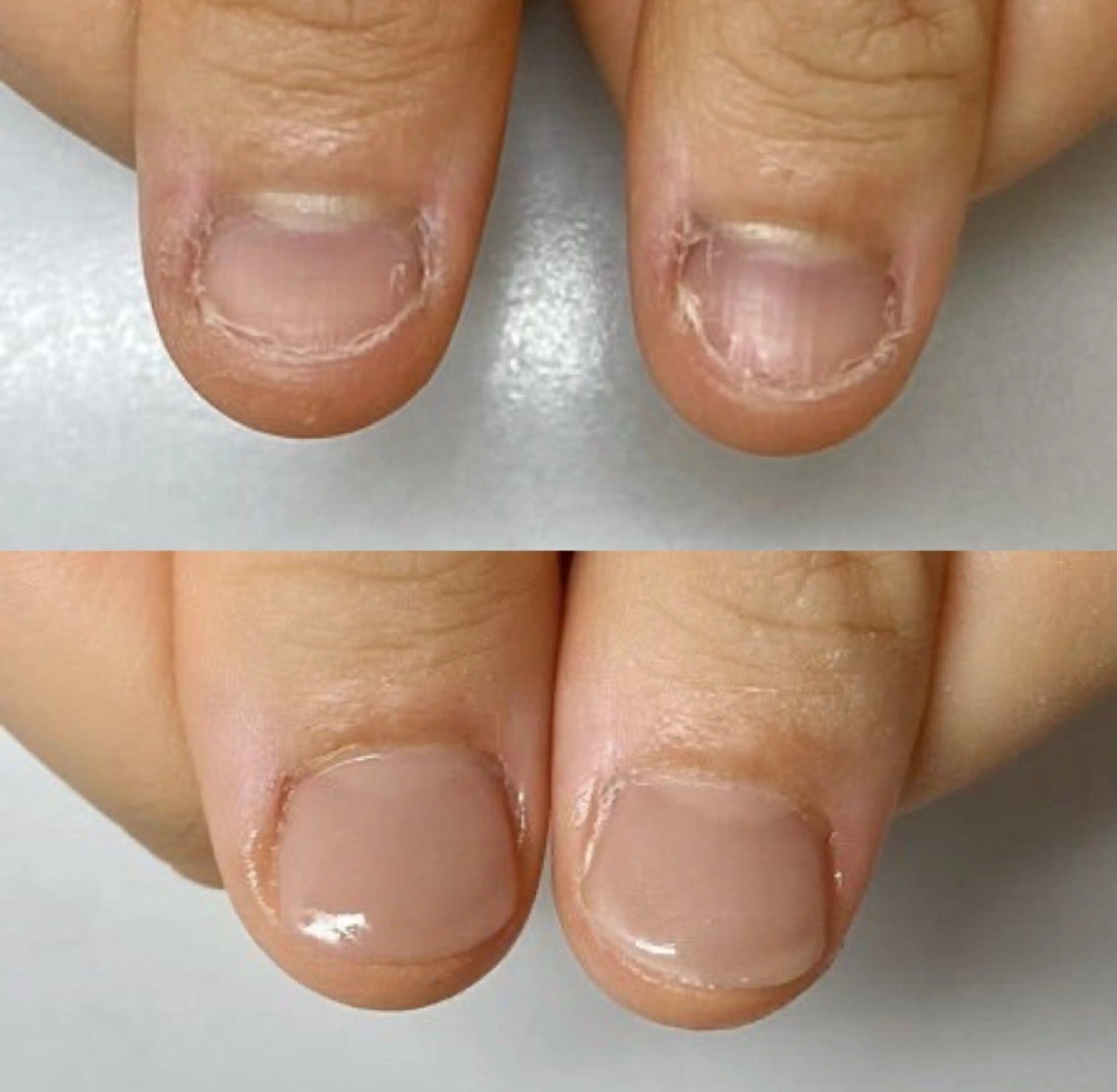 ネイル ネイルサロン アリュームのネイルデザイン