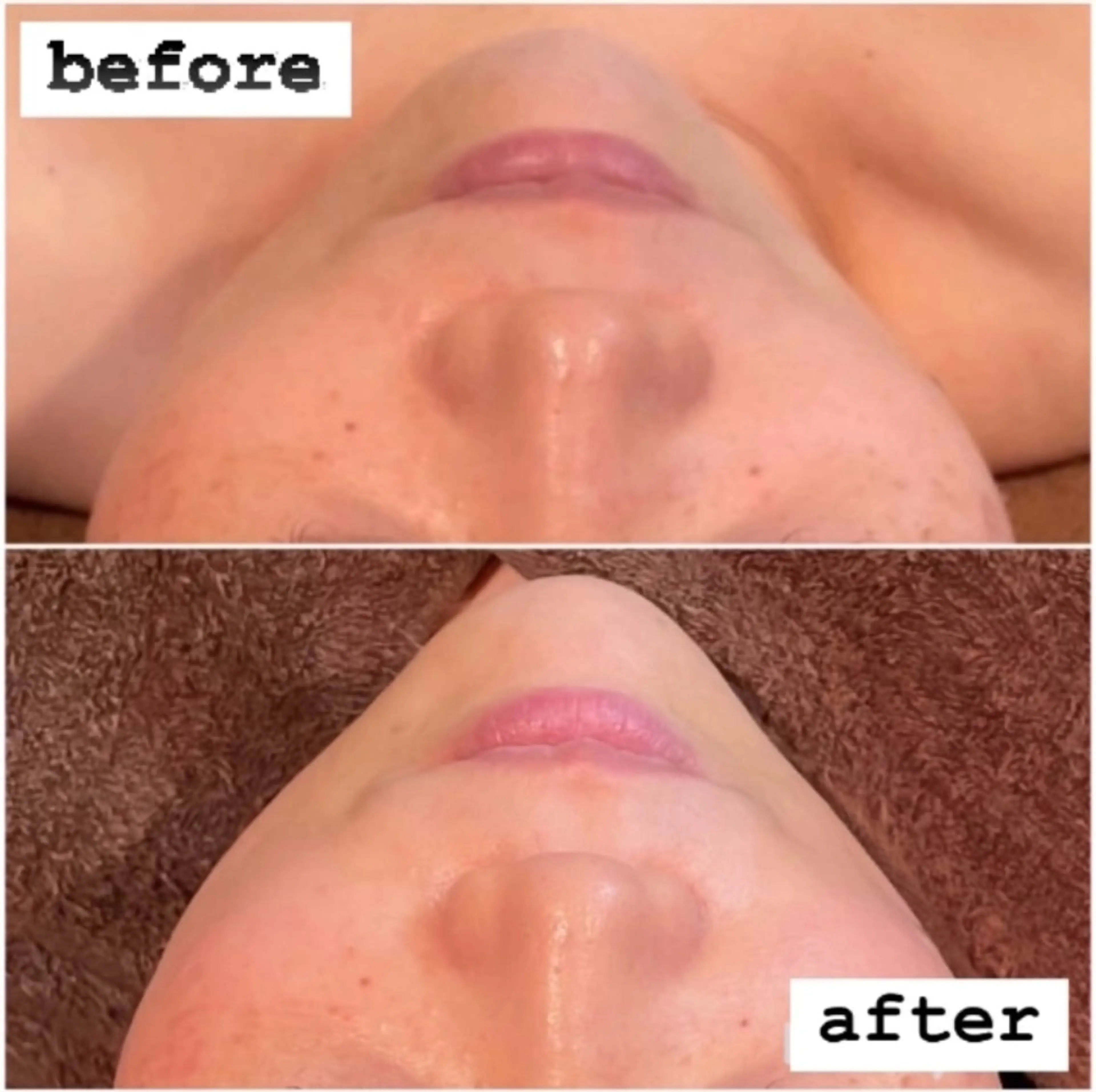 エステ リラク 🍀fleur🍀 杉浦のエステ・リラクイメージ