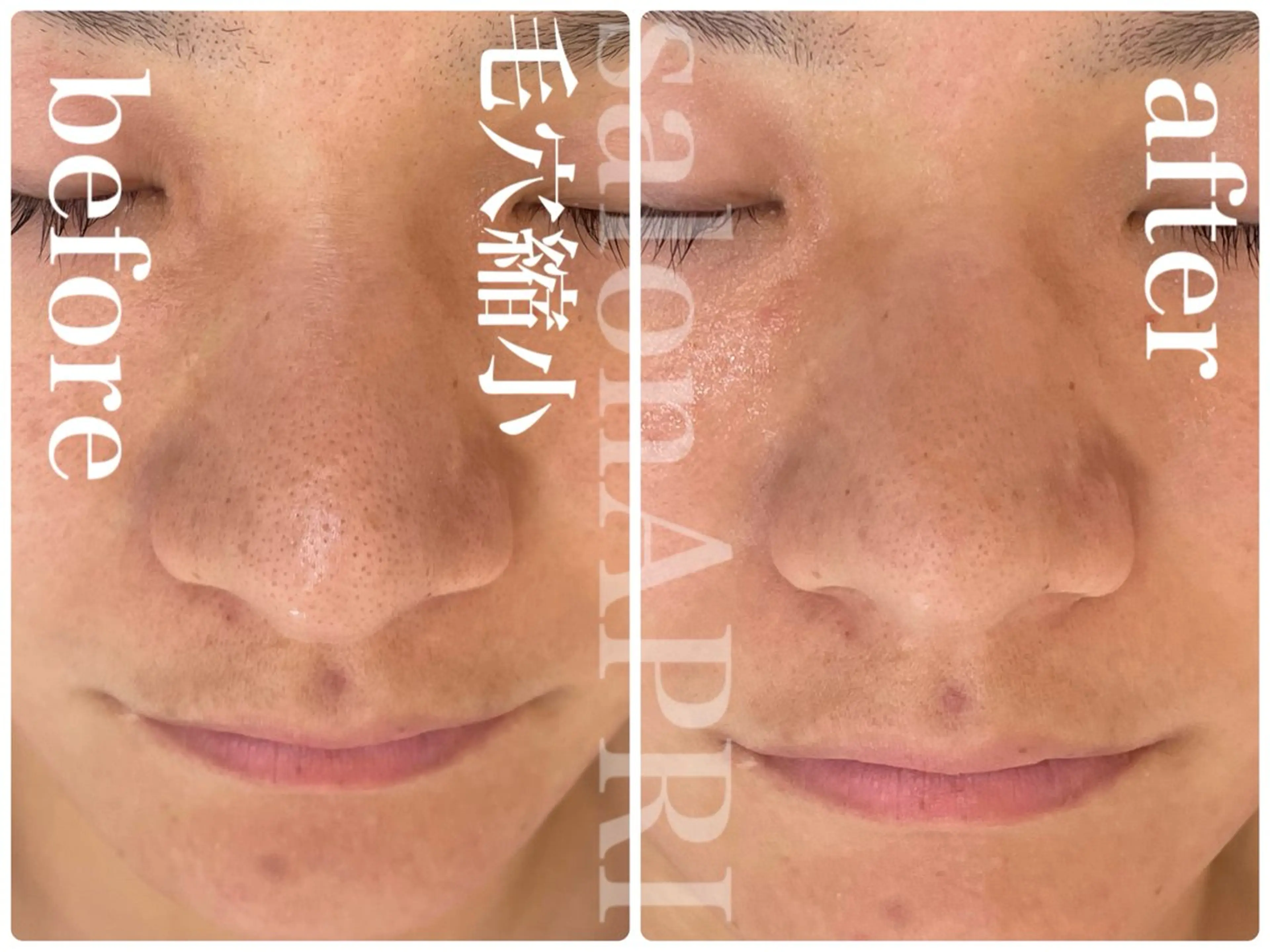 エステ リラク パーソナルスキンケア 🦋APRI🅿️有のエステ・リラクイメージ