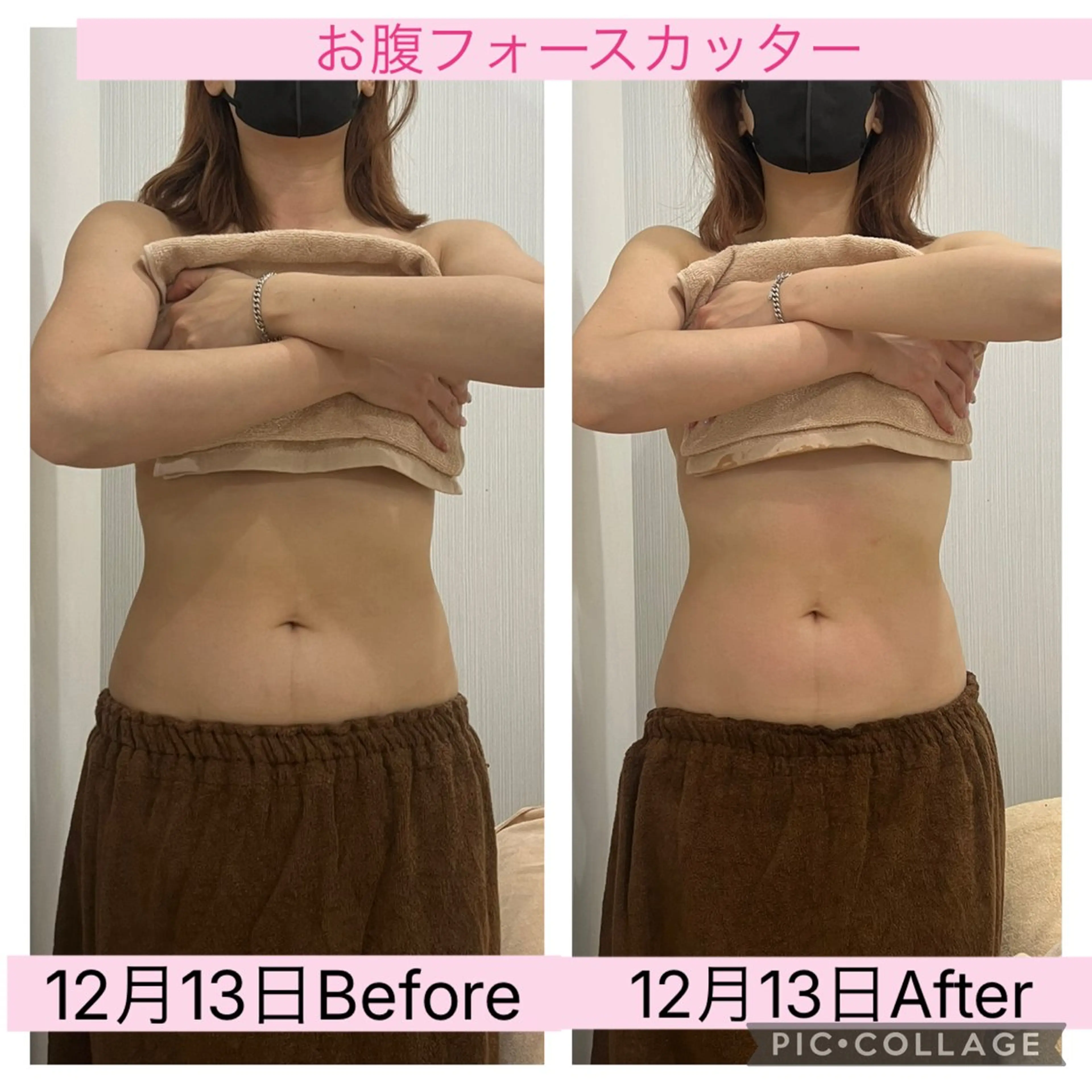 エステ ブライダル痩身×脱毛 尼崎駅前サロンのエステ・リラクイメージ