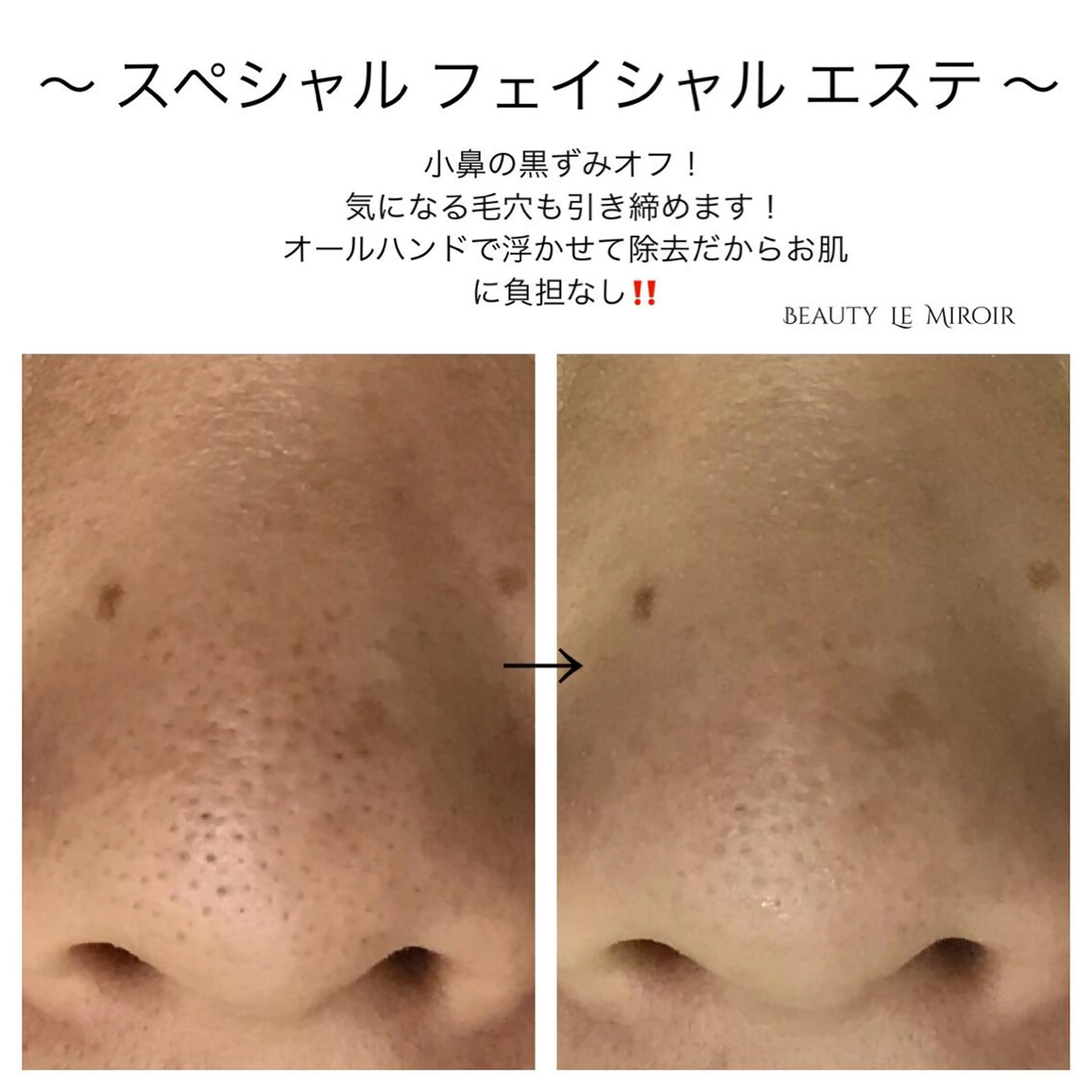 ビューティー ミロワールのエステ・リラクイメージ