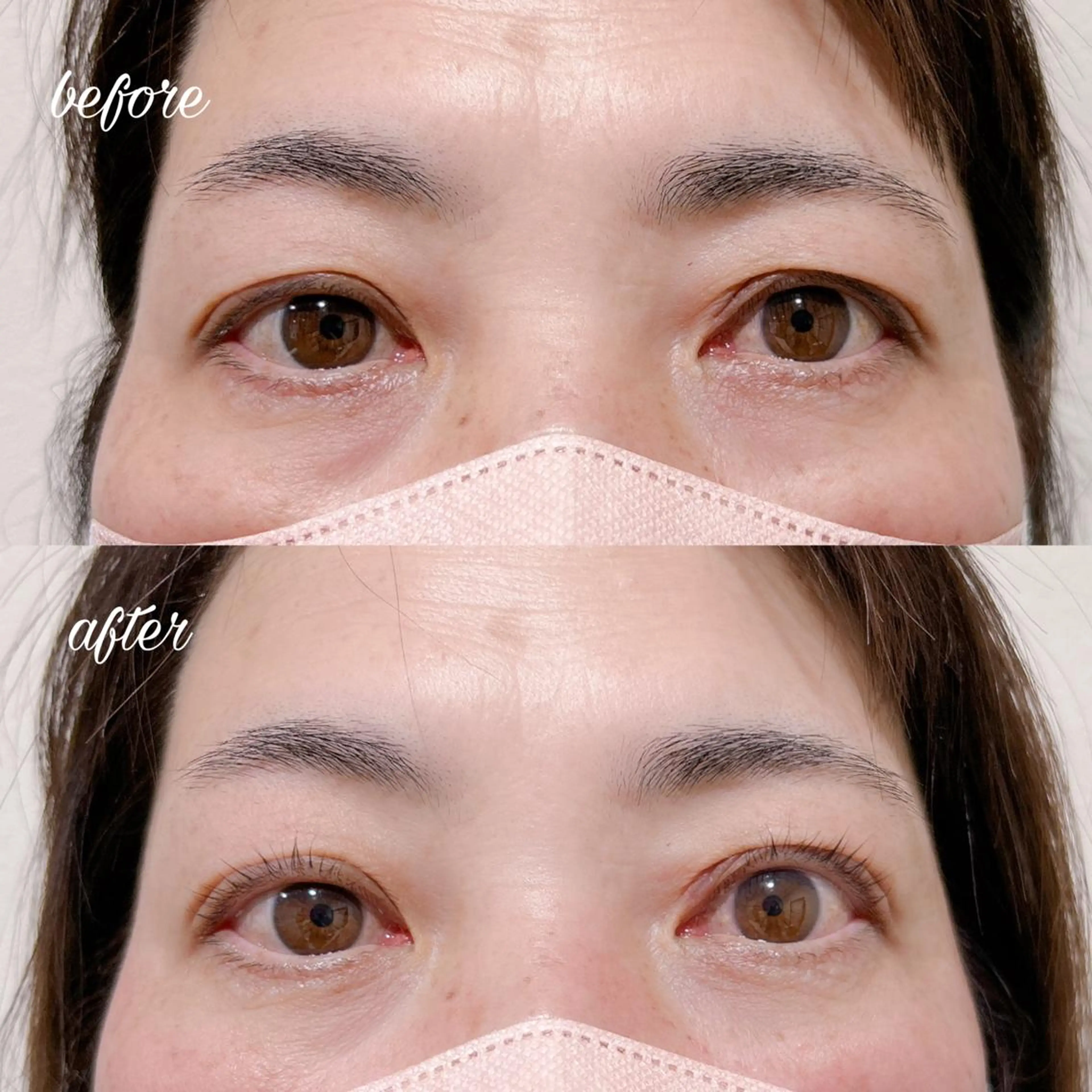 マツエク・マツパ マツパ まつげ/整体/にきび ・アトピー専門サロンのマツエク・マツパデザイン