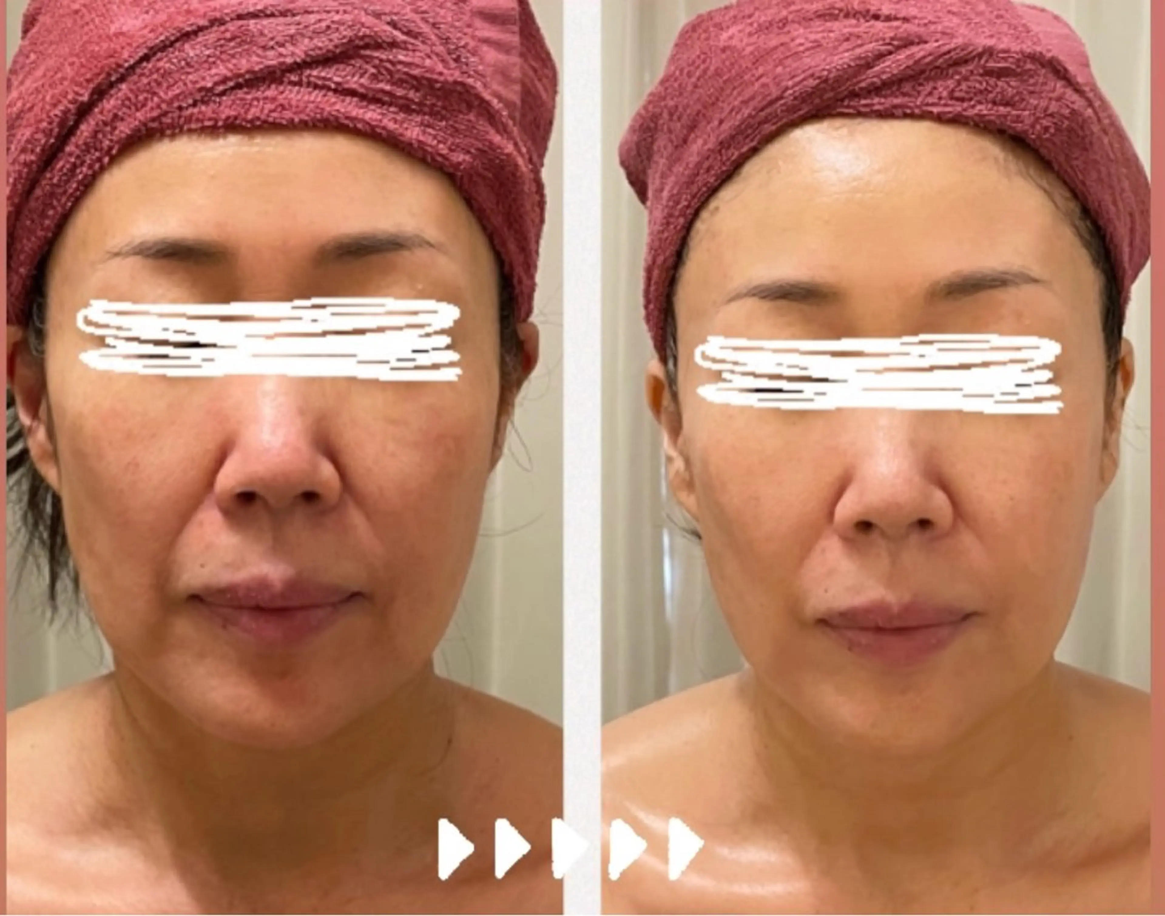 35歳からの エイジングケアサロンのエステ・リラクイメージ