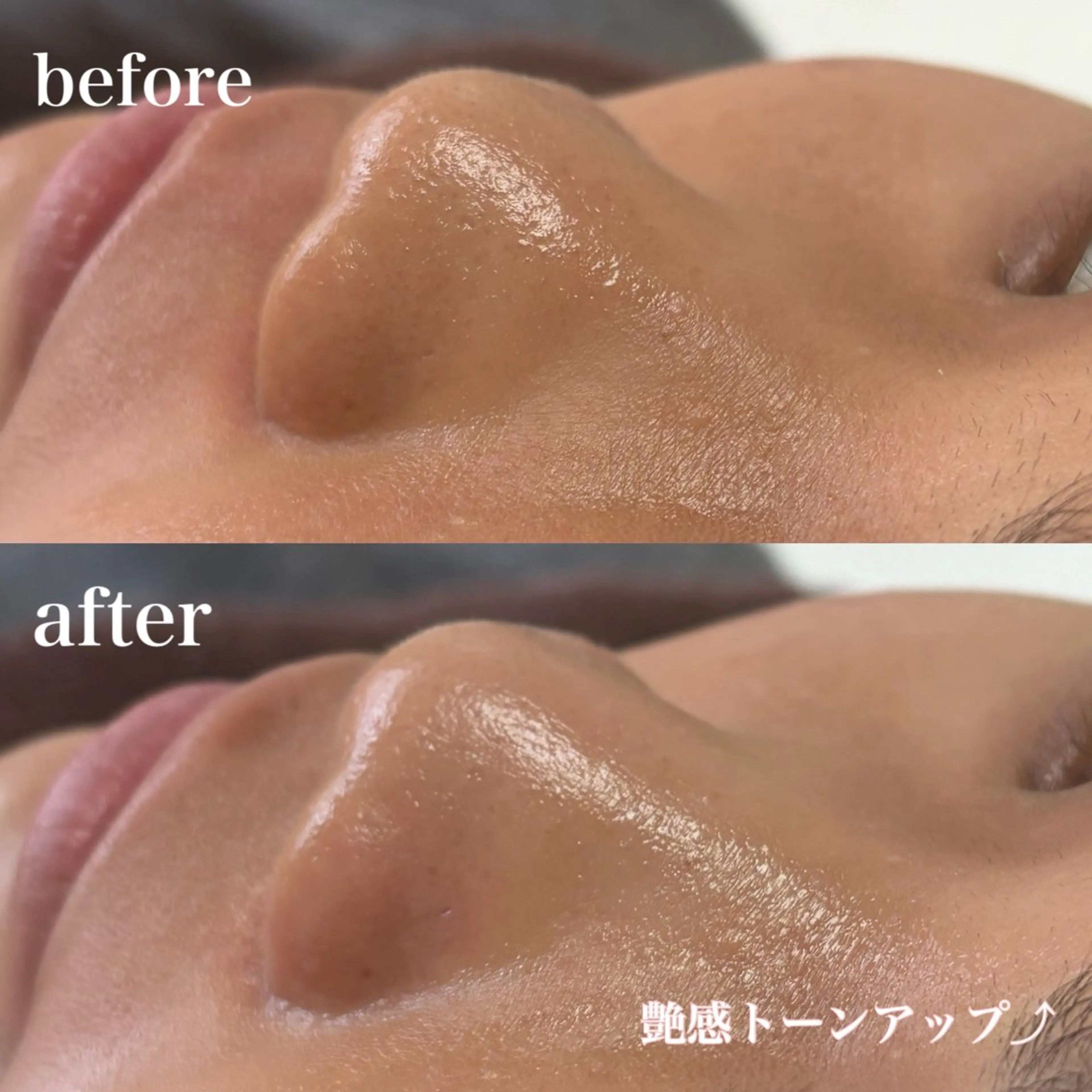 【🎗️ここでしか受けられない】艶モチ肌感動レベルの透明感フルコース（ハイドラ×フェイシャルワックス×ビタミンC導入）の写真