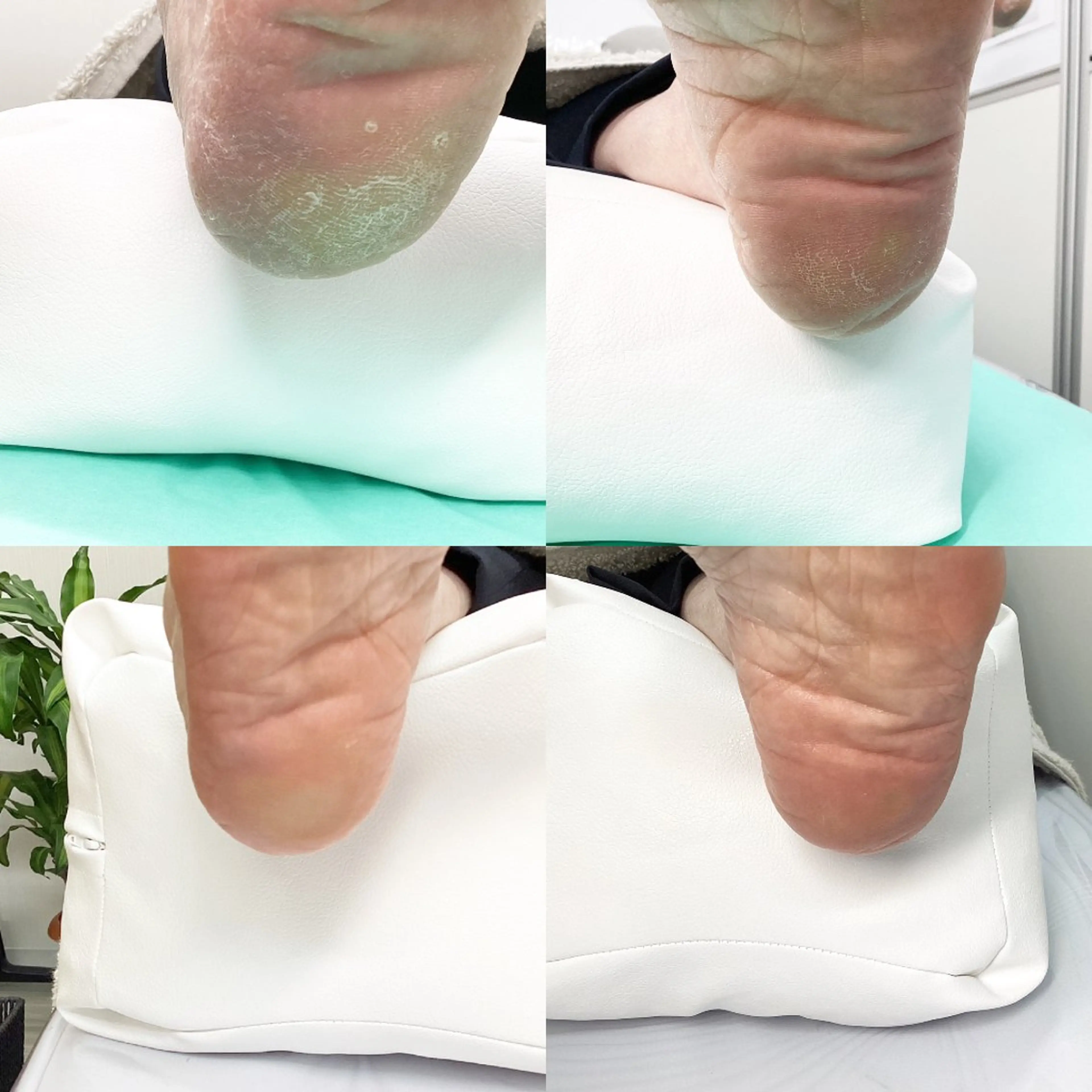 その他 巻き爪補正店 大阪なんば店のネイルデザイン