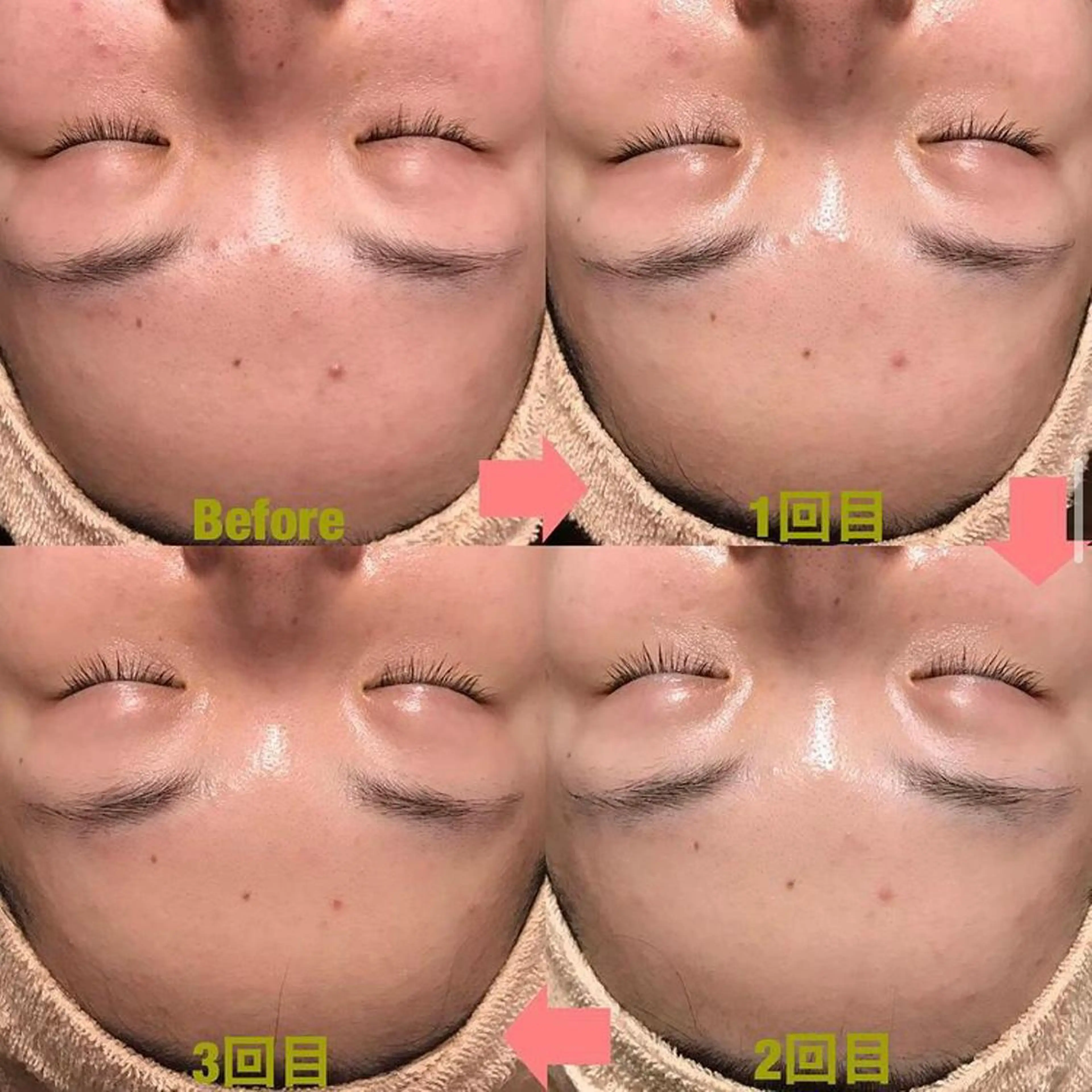 エステ ゆか/エステサロン Lilasmileのエステ・リラクイメージ