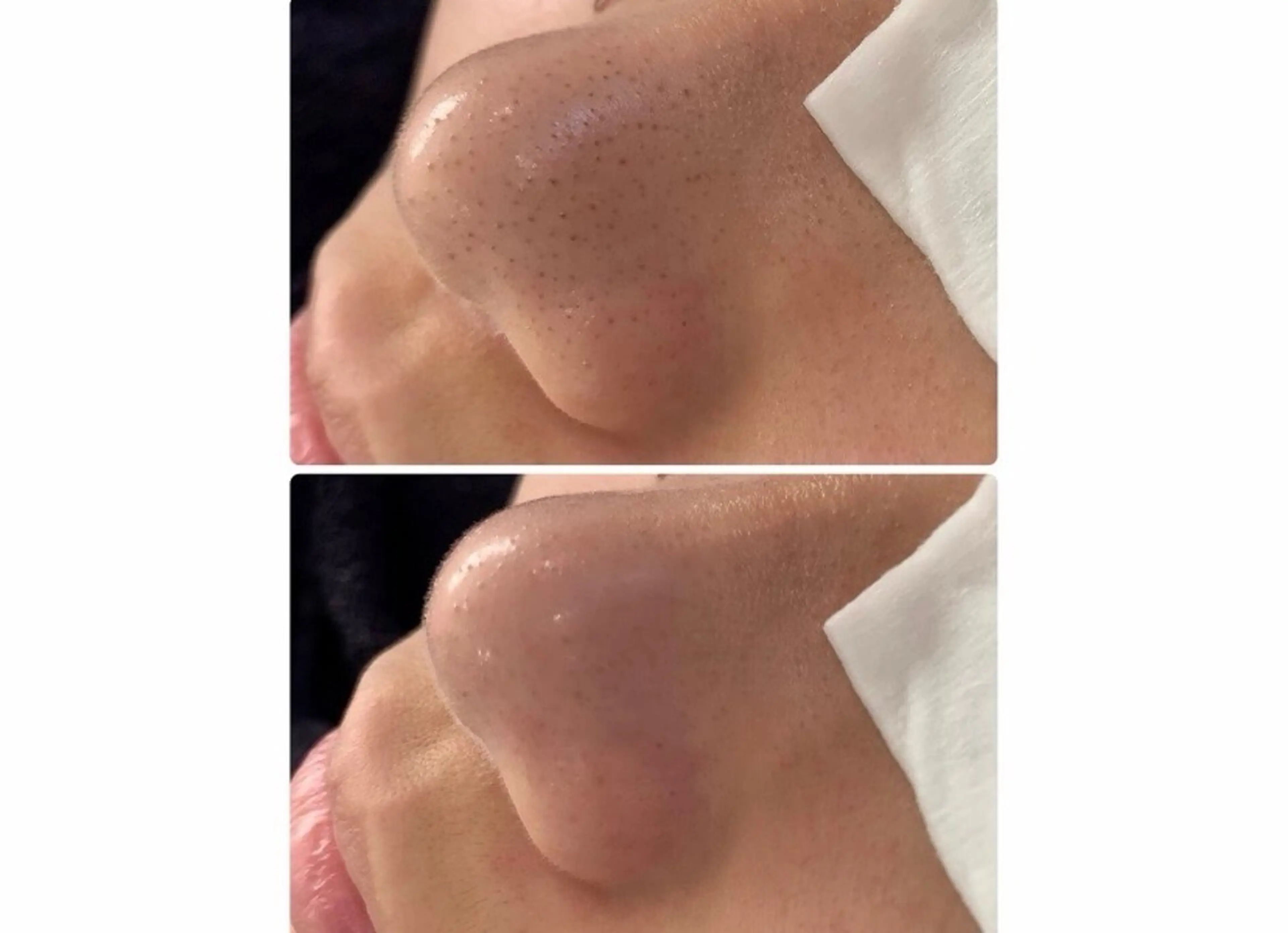 エステ 菊池 歩美のマツエク・マツパデザイン