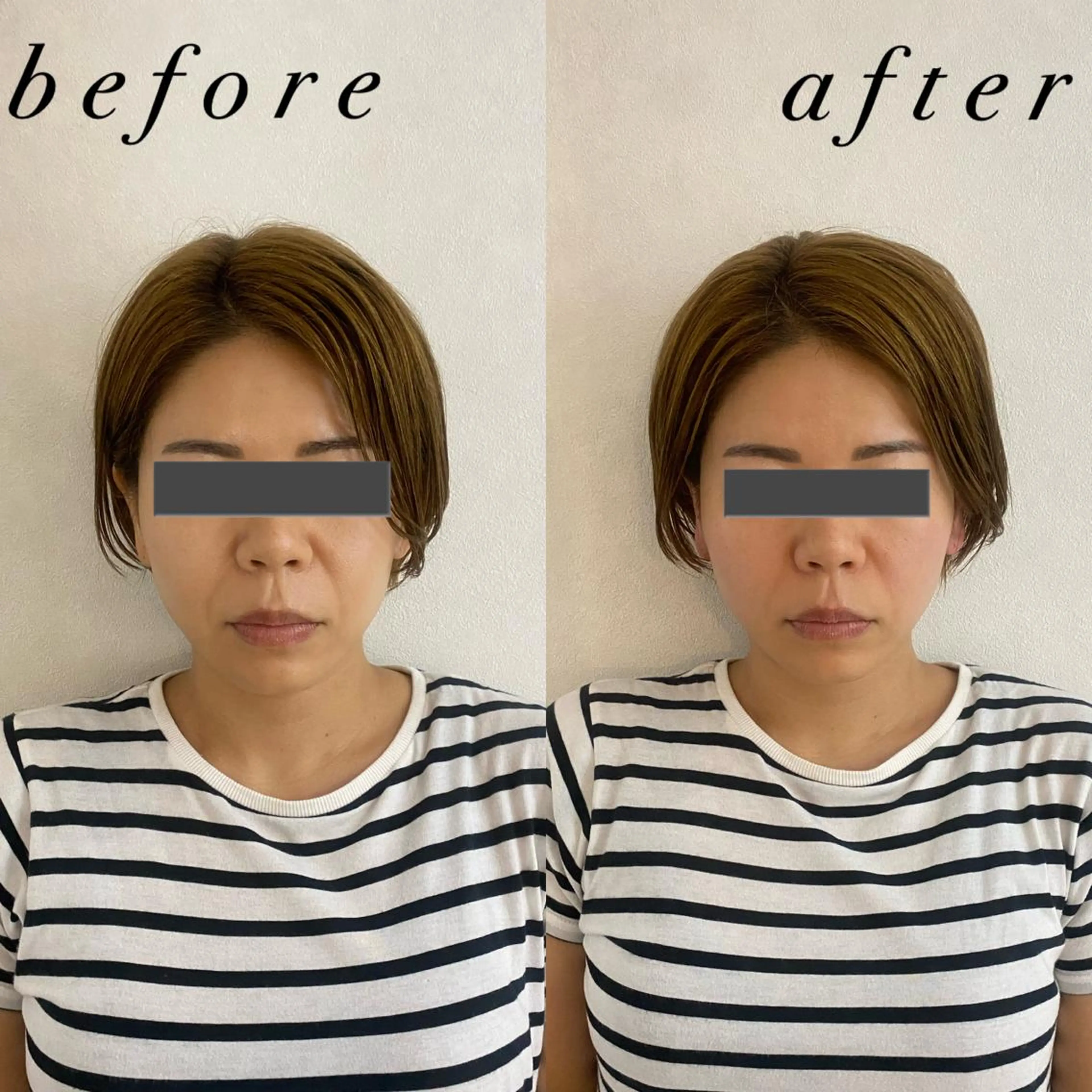 うなじ脱毛/美肌脱毛 LABELのエステ・リラクイメージ