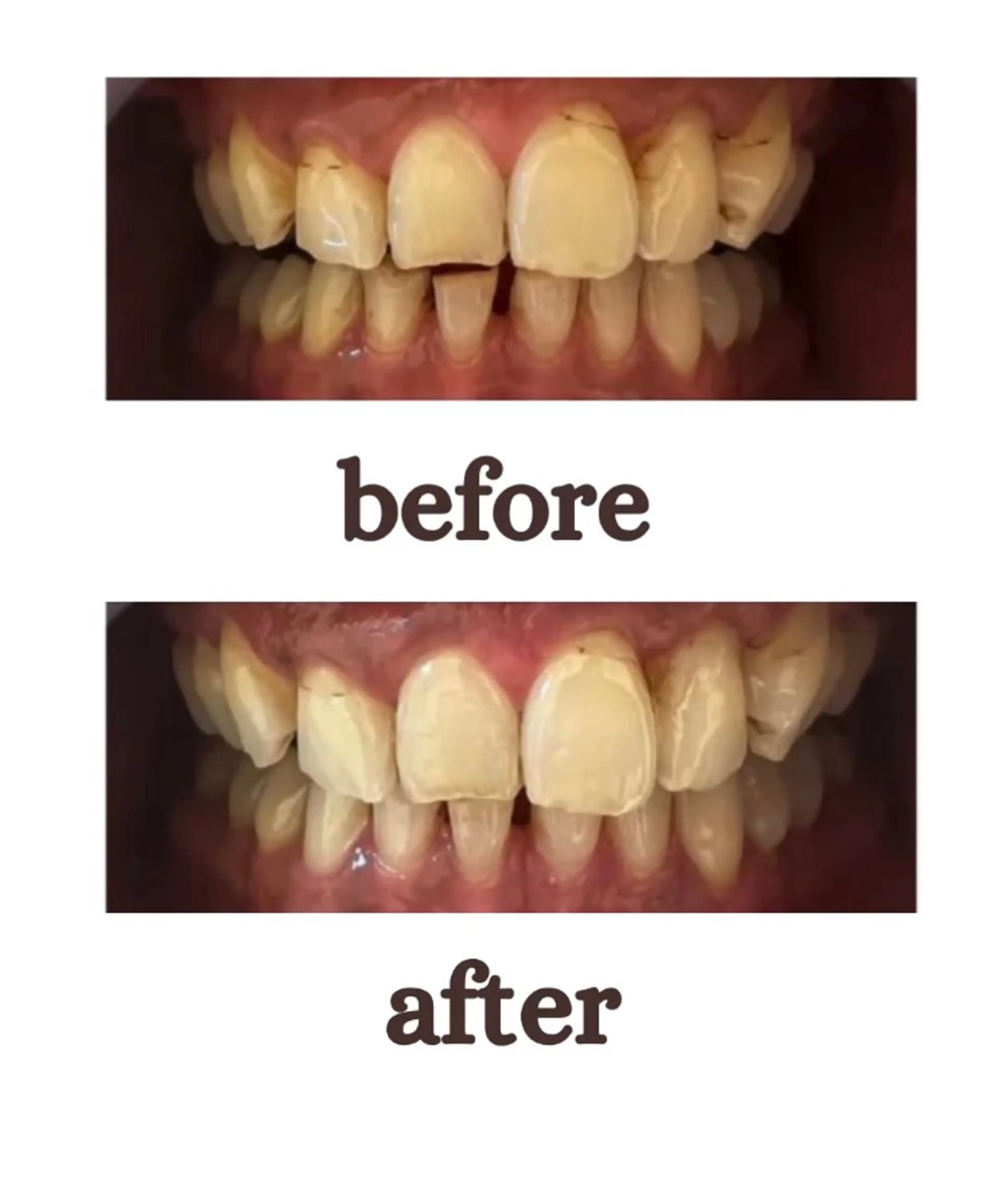 その他(ネイル) Nailbeauty marcherのネイルデザイン