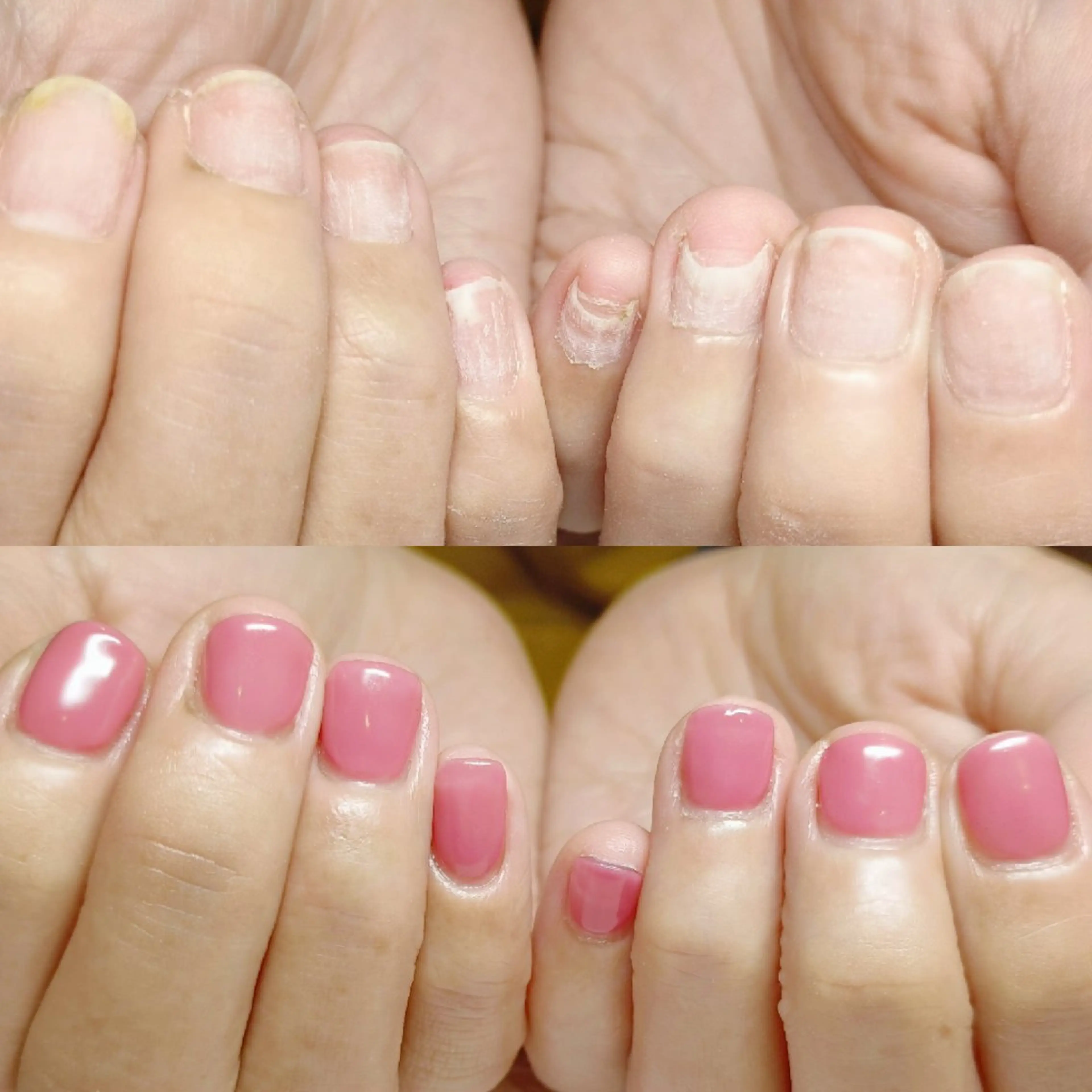 ネイル ハンドネイル ハンドケア 深爪矯正/爪育成ケア manie nailのネイルデザイン