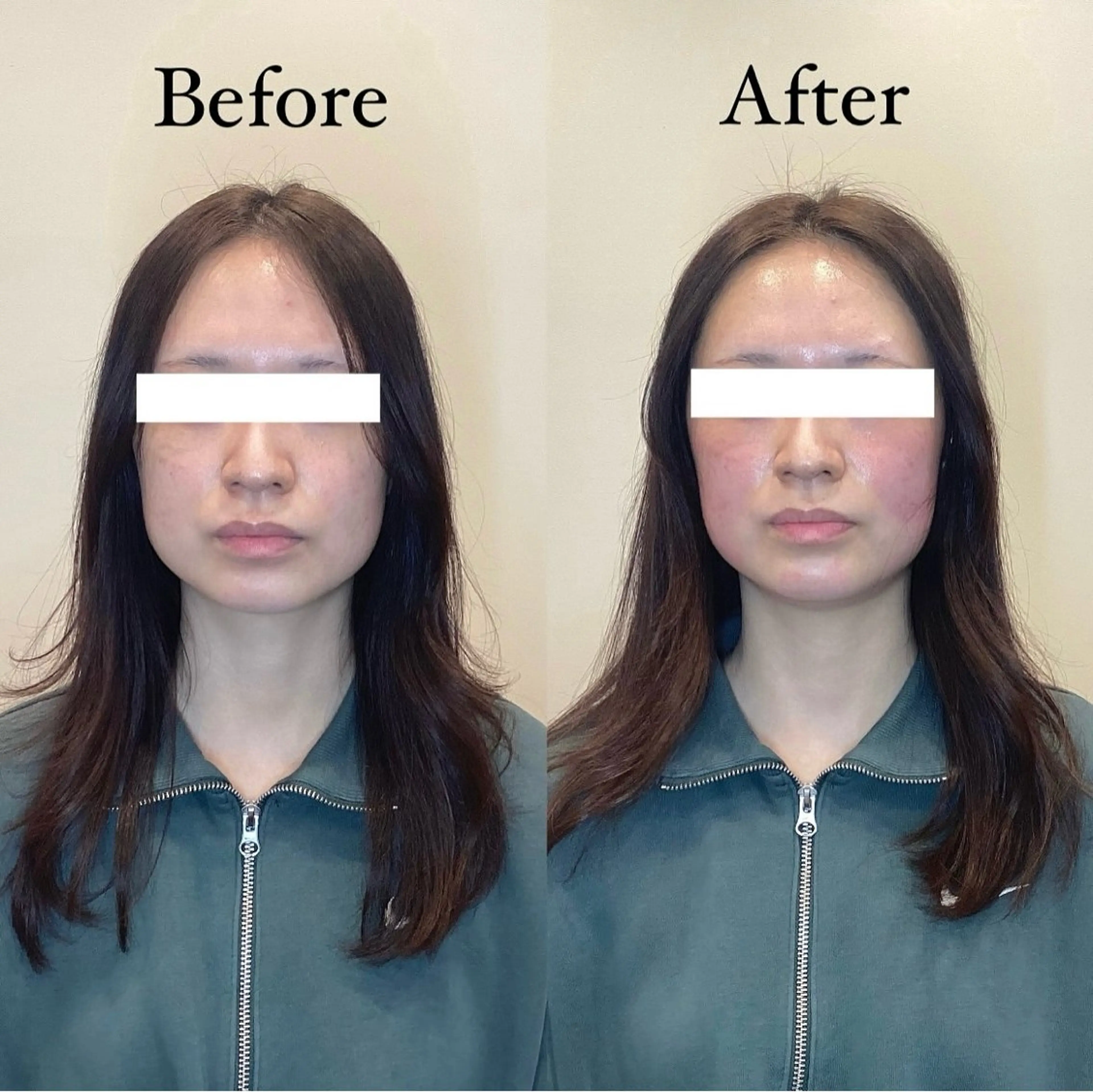 メンズ natsuki ハリラウンジ梅田のエステ・リラクイメージ