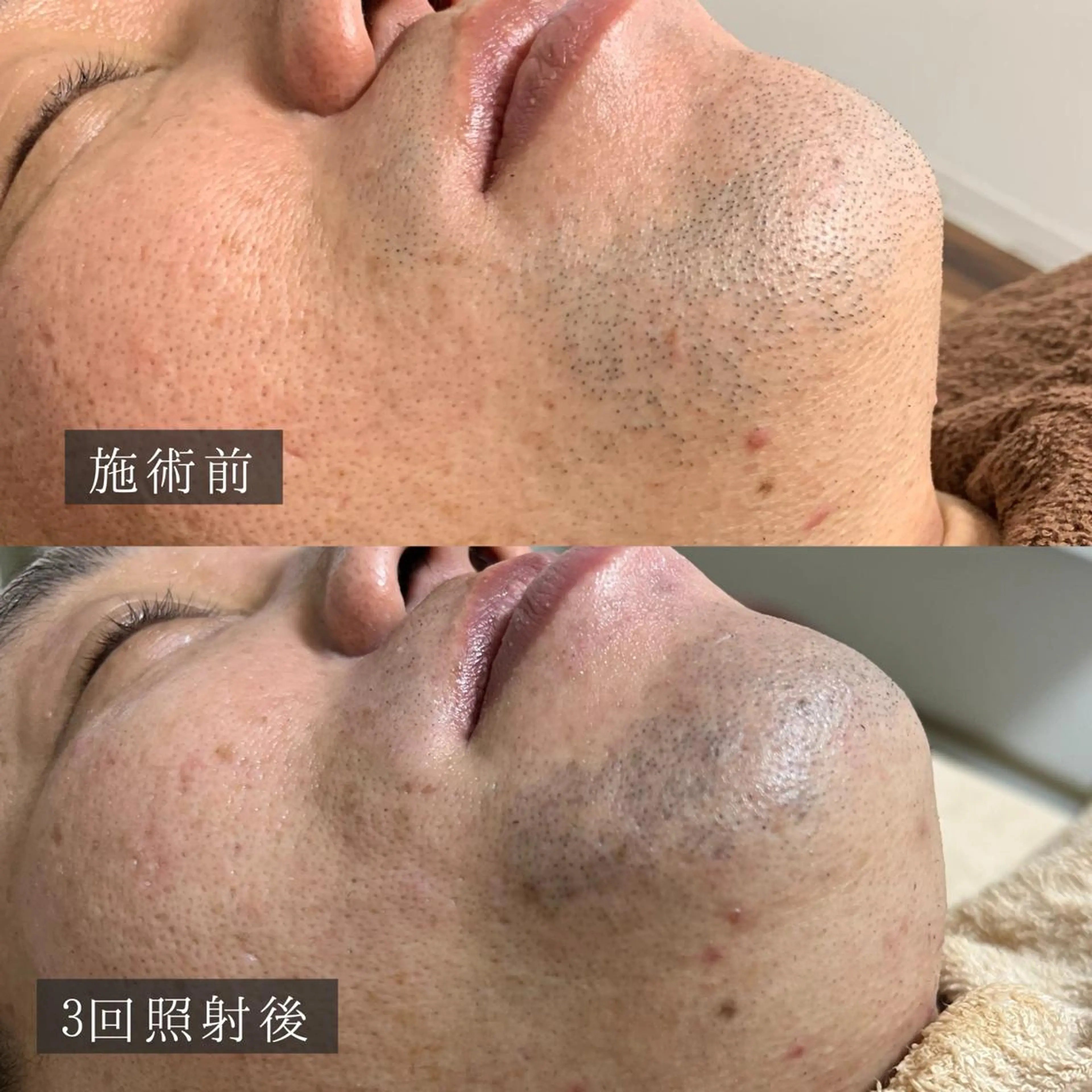 メンズ 脱毛 脱毛専門サロン BELFINE恵比寿のエステ・リラクイメージ