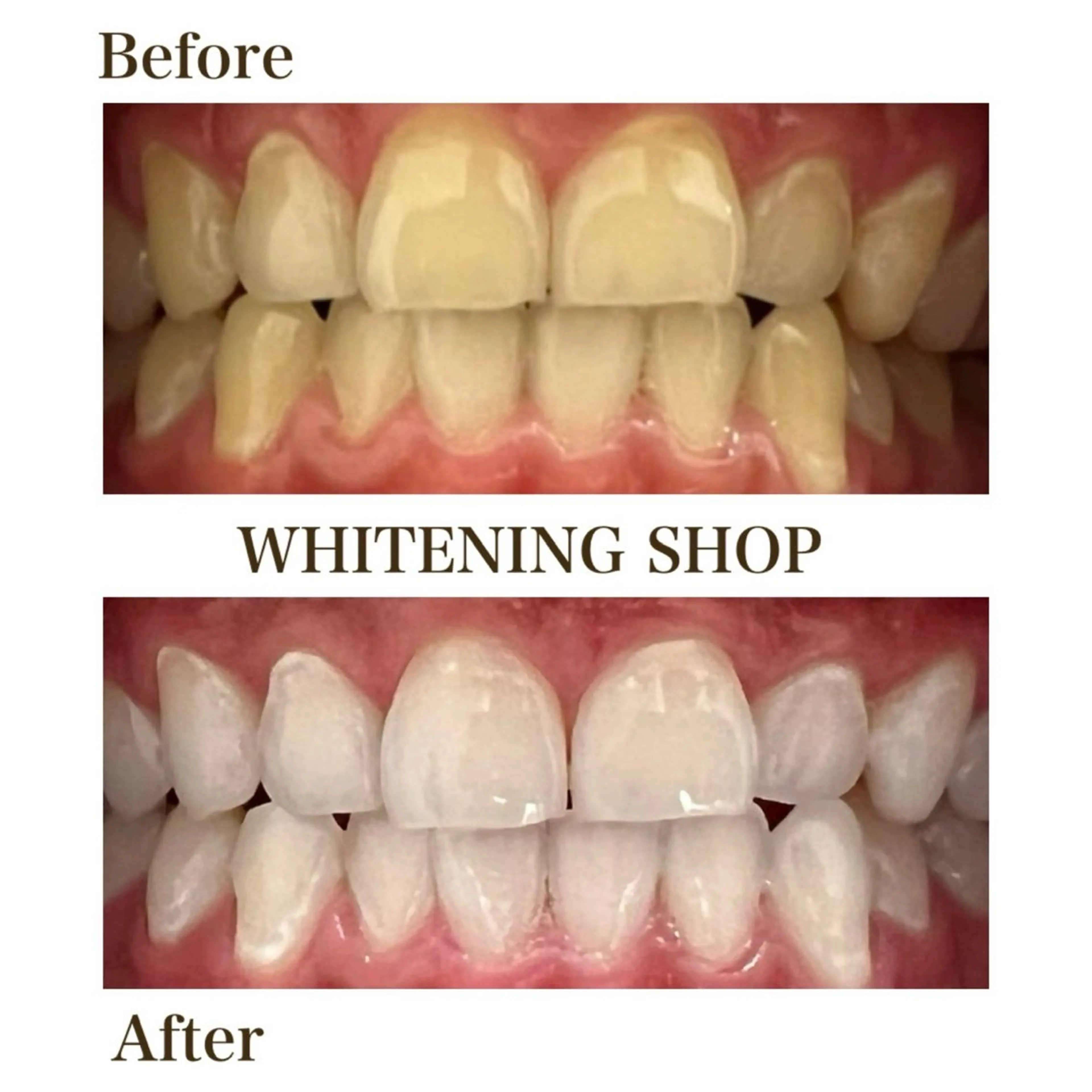 その他 ホワイトニング ショップ葵区静岡駅店のその他イメージ