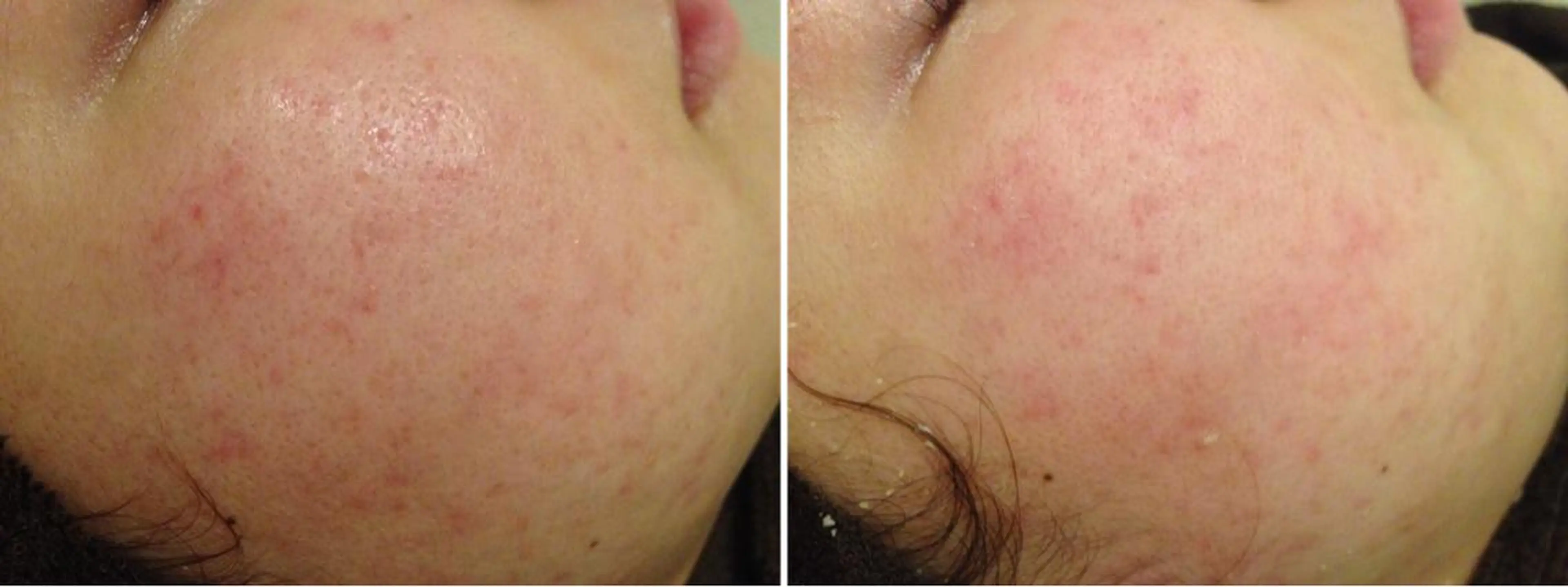 ミディアム カラー パーマ ヘアアレンジ メンズ キッズ ネイル マツエク・マツパ アニメ,Vオタク× 即効痩せエステサロンのエステ・リラクイメージ