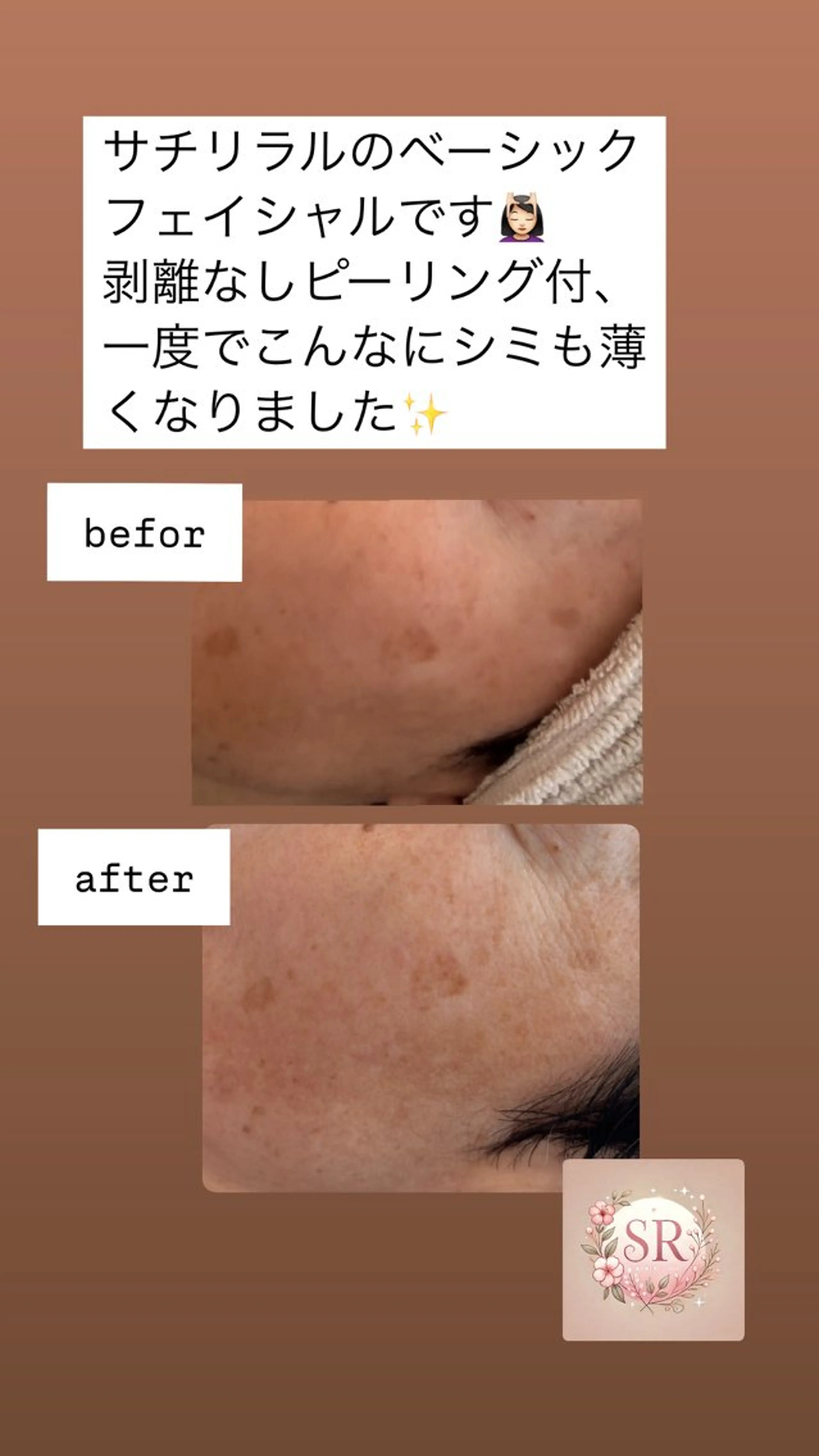 Sachi Riraruのエステ・リラクイメージ