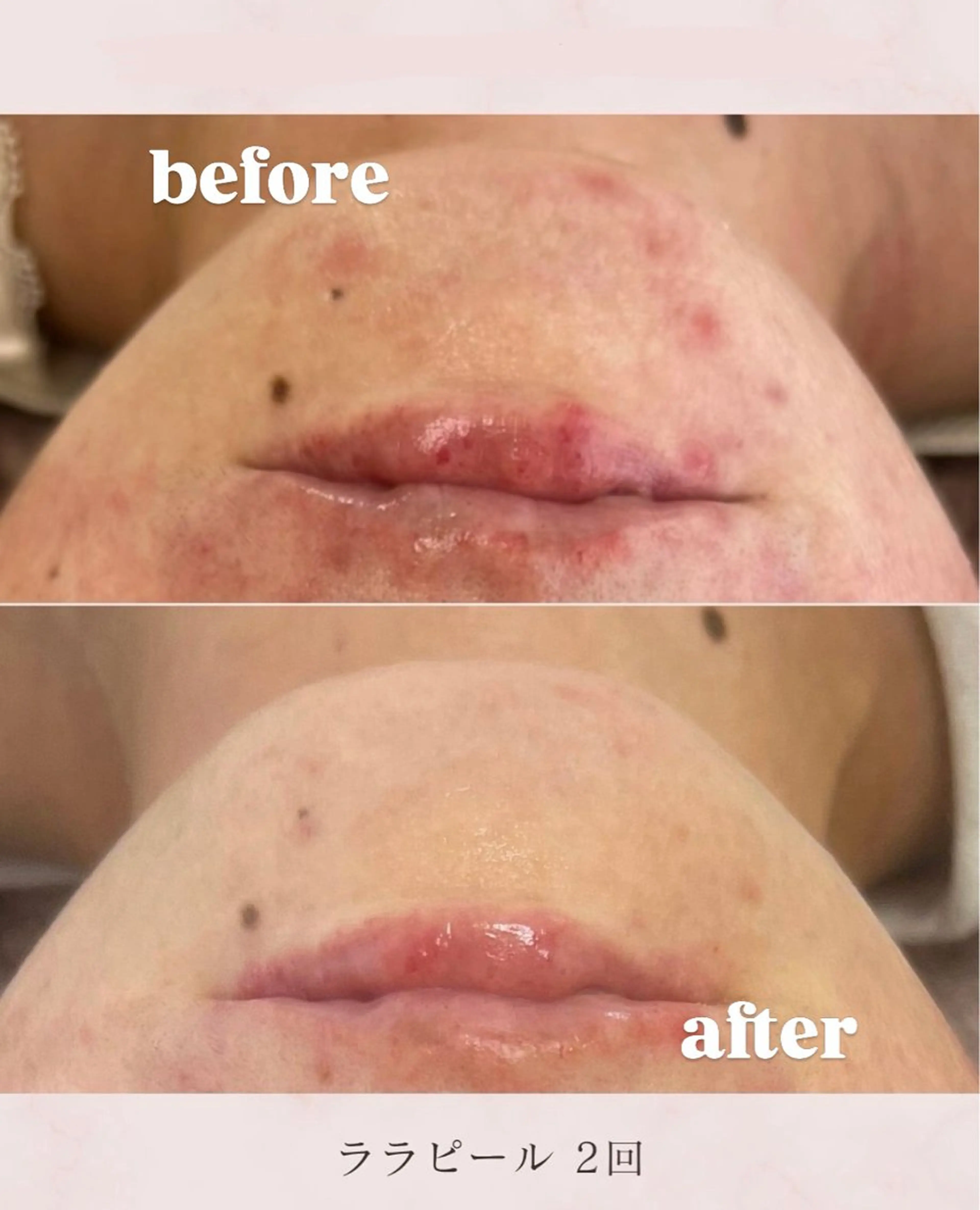 看護師が施術する美顔 サロン／mizukiのエステ・リラクイメージ