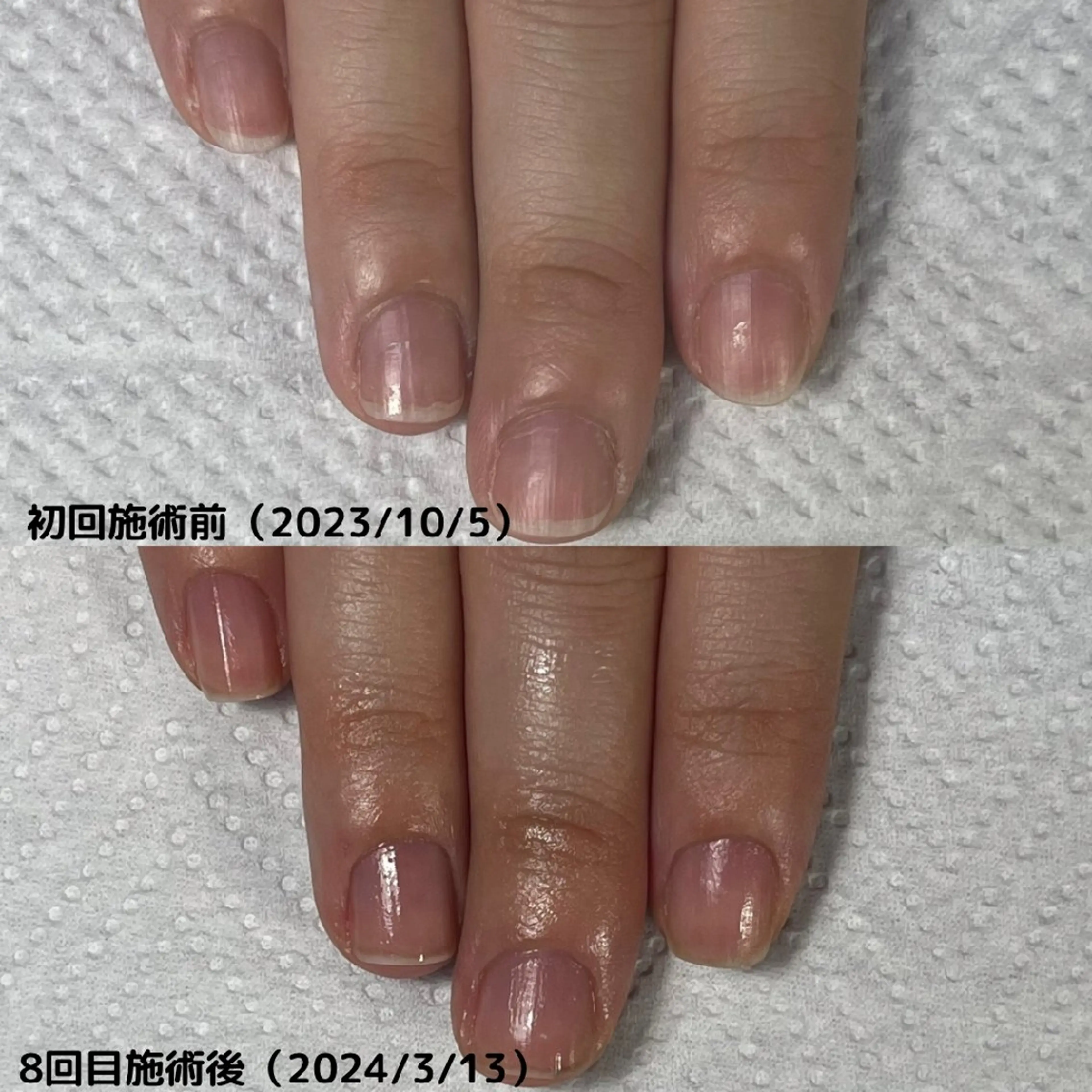 ネイル nail 1623のネイルデザイン