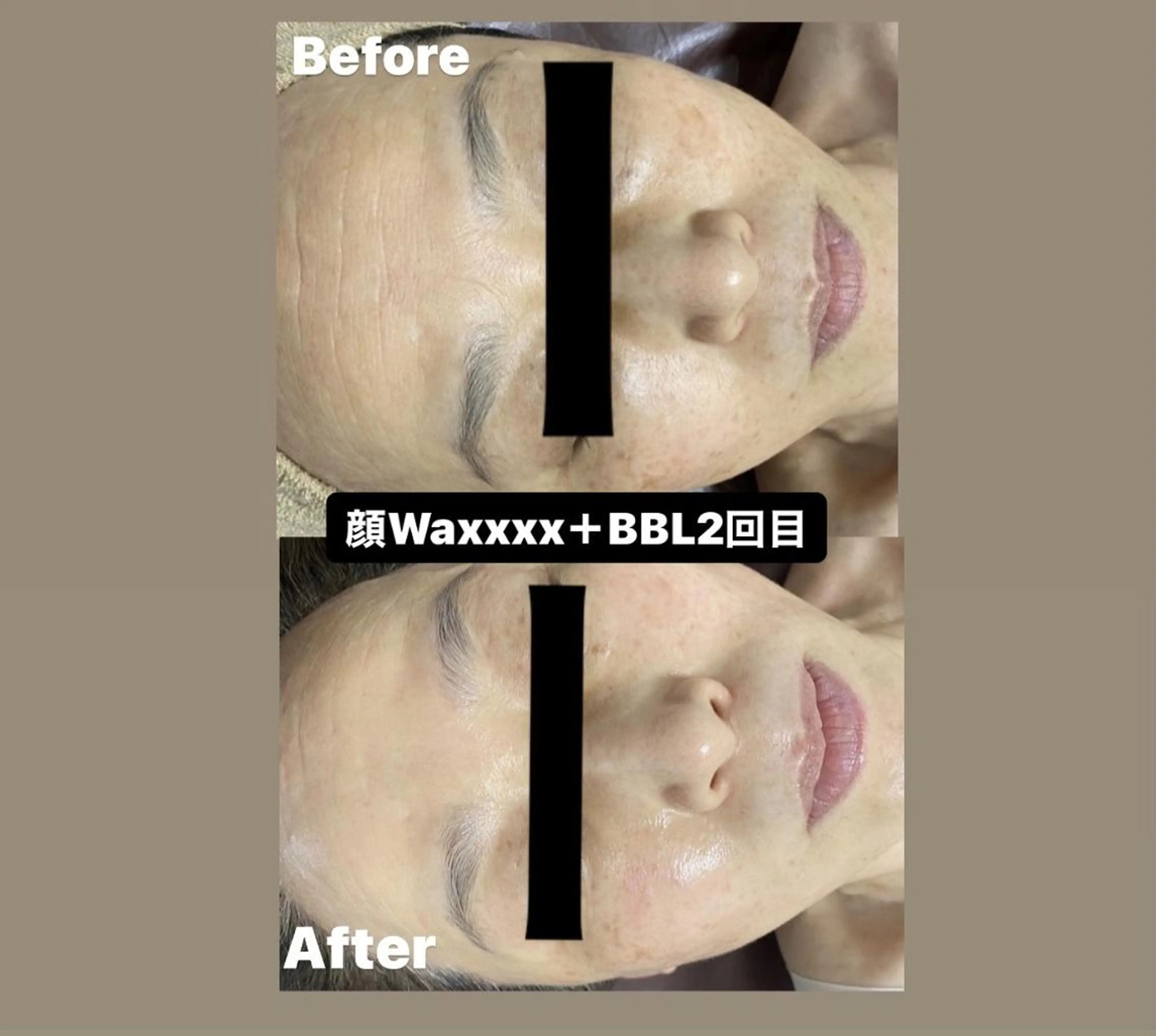 脱毛 Epina 千葉店 【エピナ】のエステ・リラクイメージ