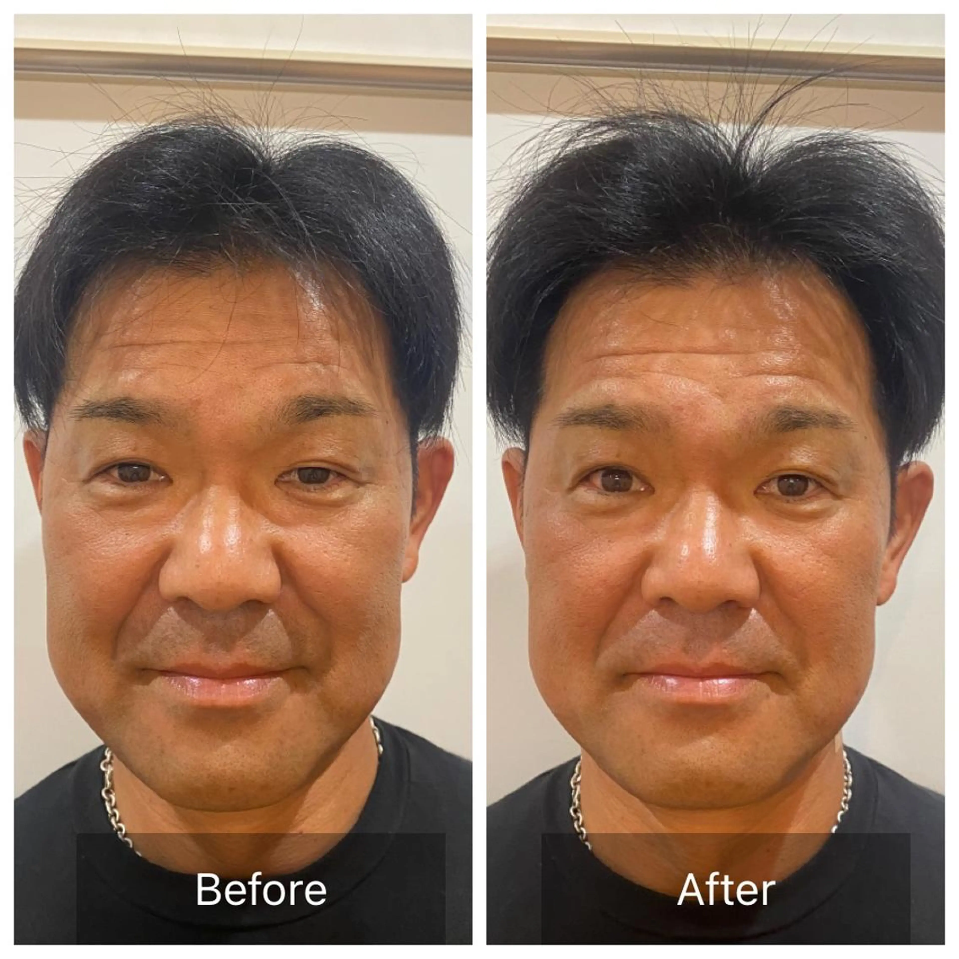 💙美容鍼💙美顔矯 正🧡Brilo🧡のエステ・リラクイメージ