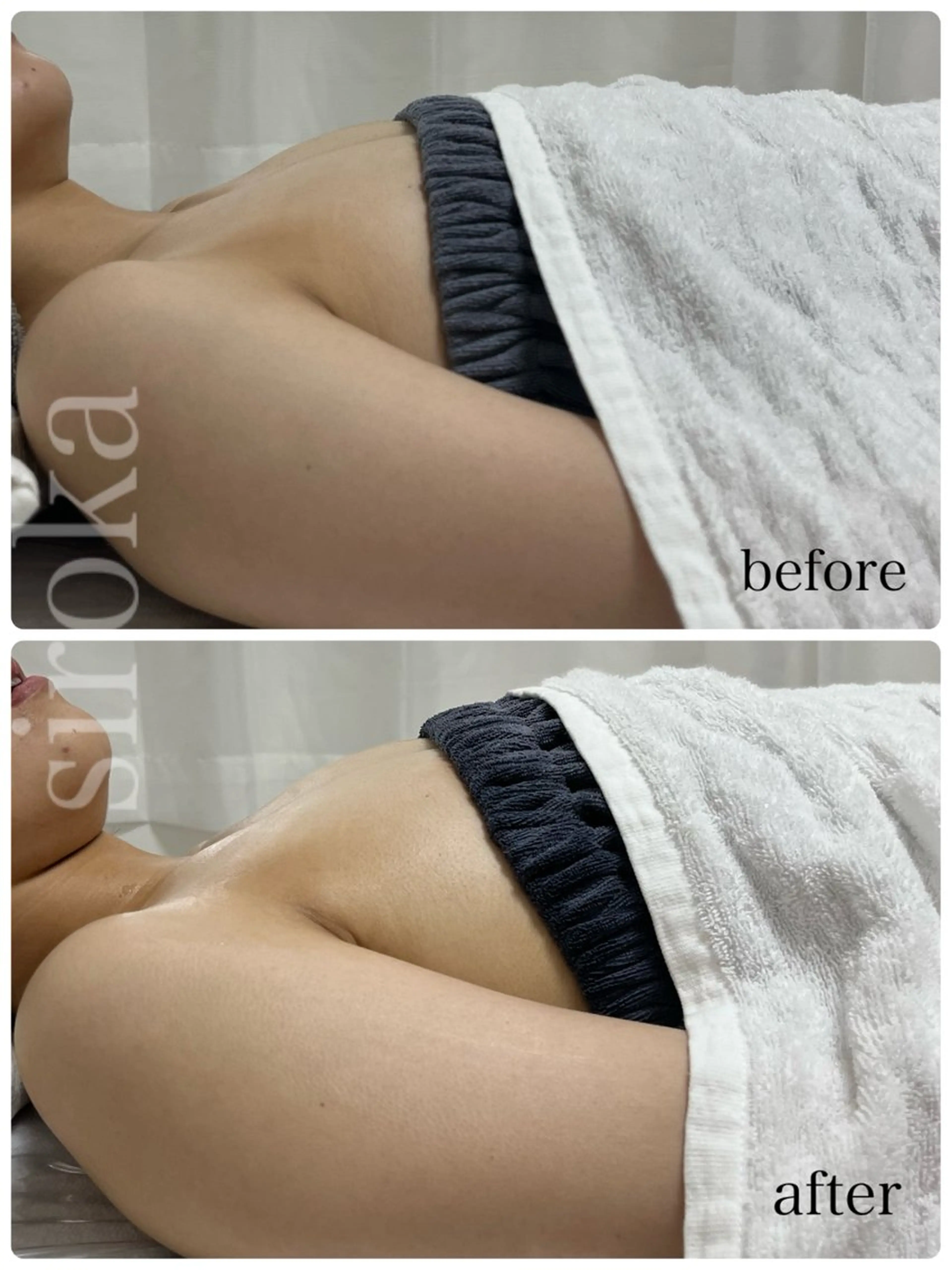 【ふわっと上向き】全身オールハンドバストケアの写真