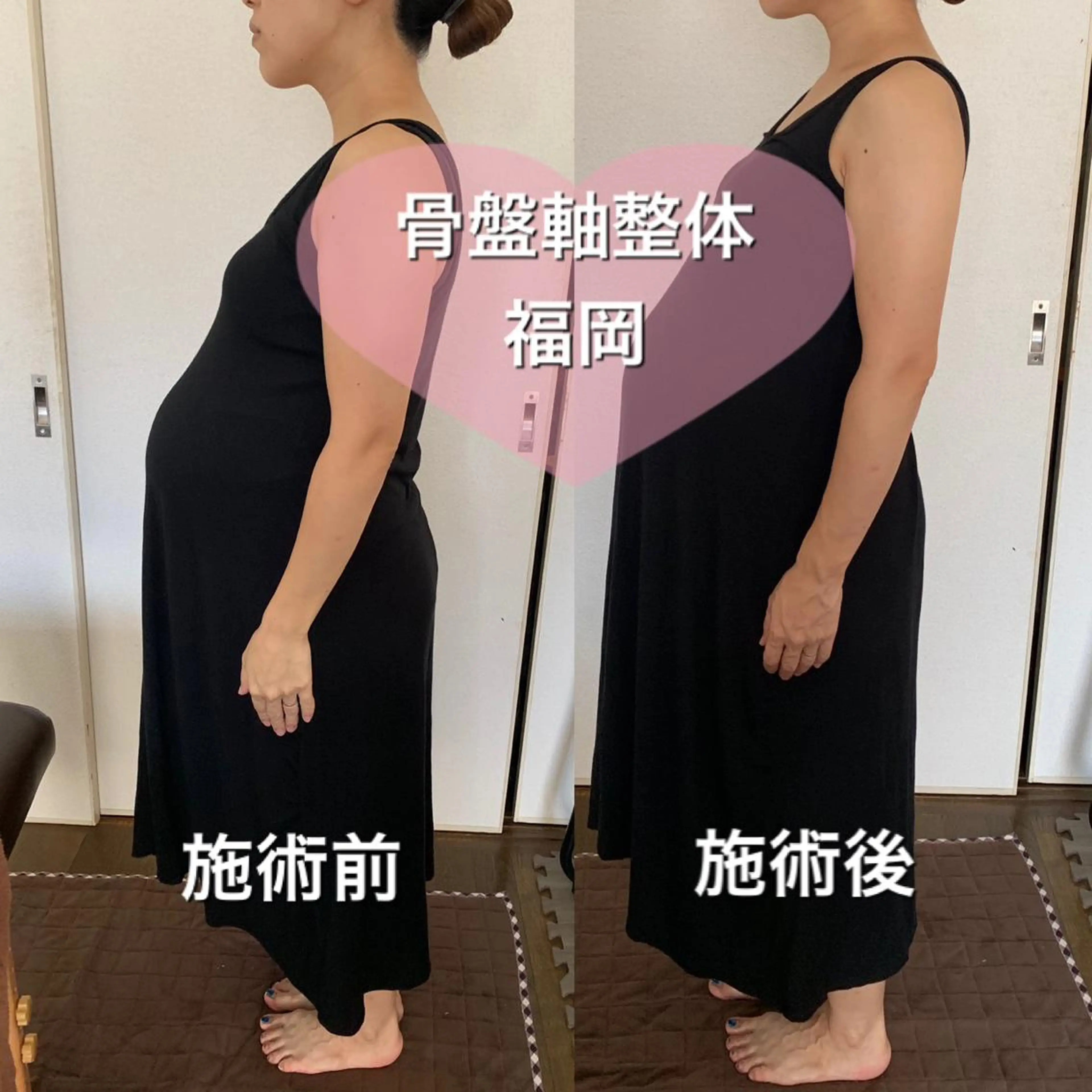 【妊娠5ヶ月目〜】マタニティフットアロマ30分＋骨盤軸整体30分＋カウンセリング20分の写真