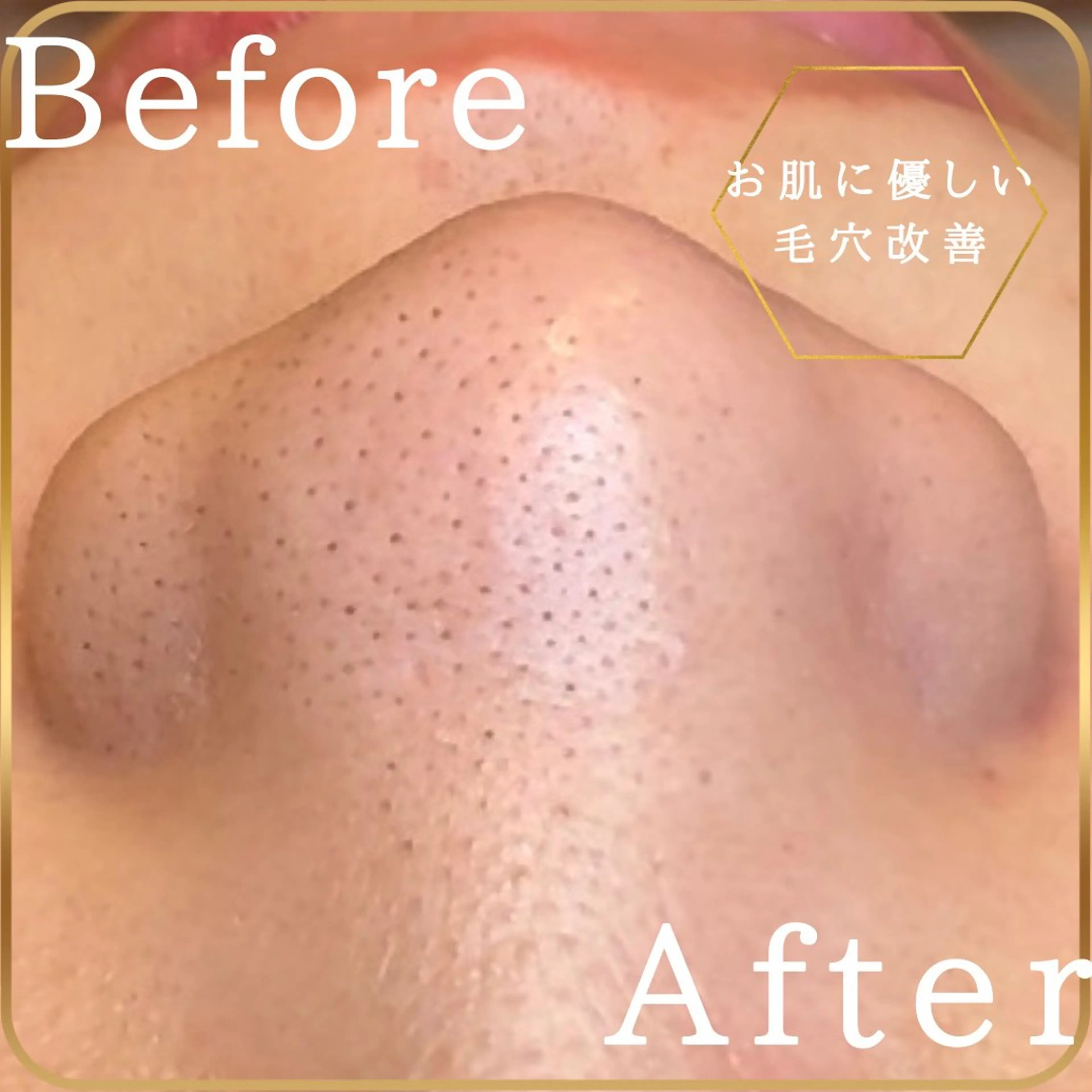 アイスリーサロン所属・毛穴改善サロン アイスリーのエステ・リラクイメージ