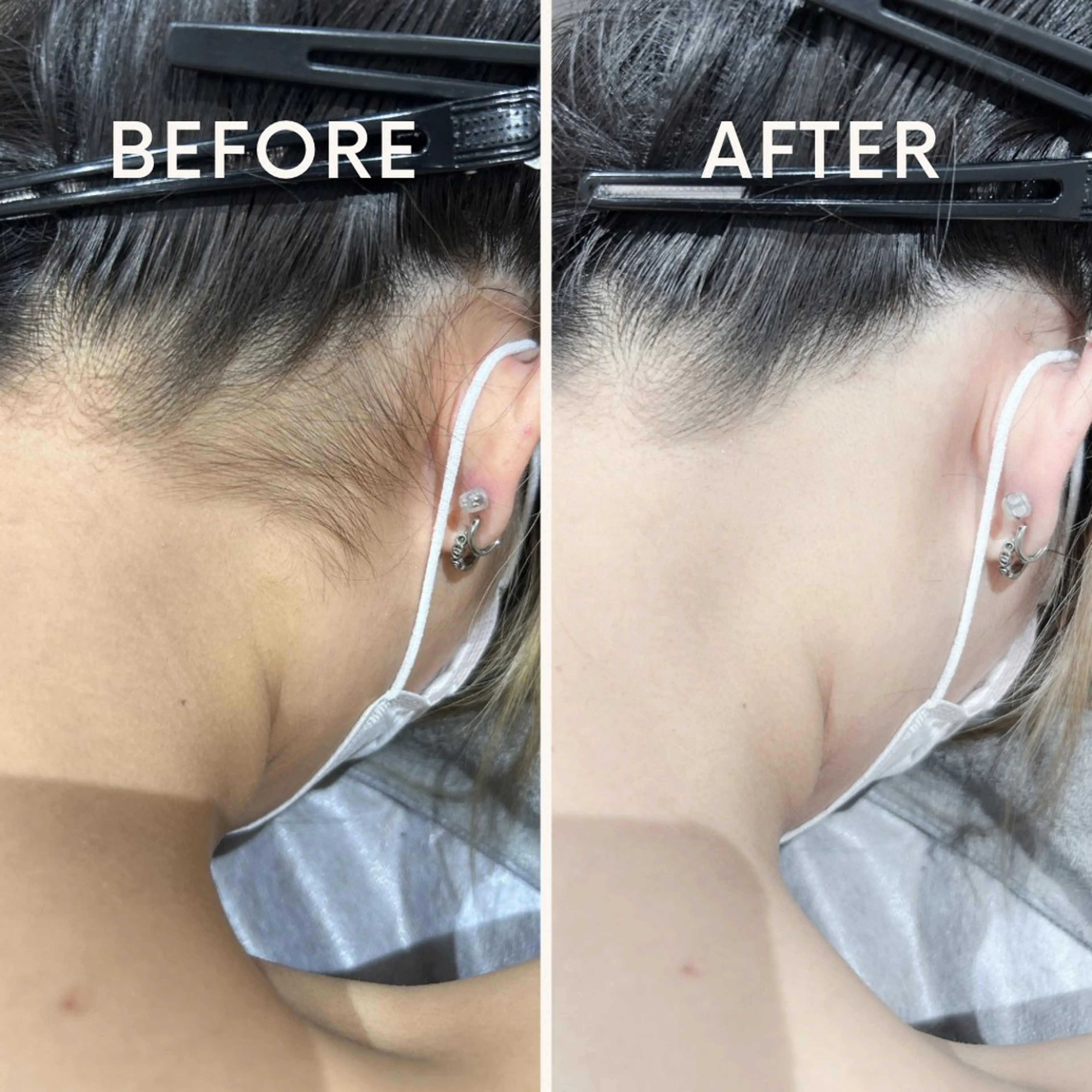 🎀RIA🎀 脱毛/フェイシャルのエステ・リラクイメージ